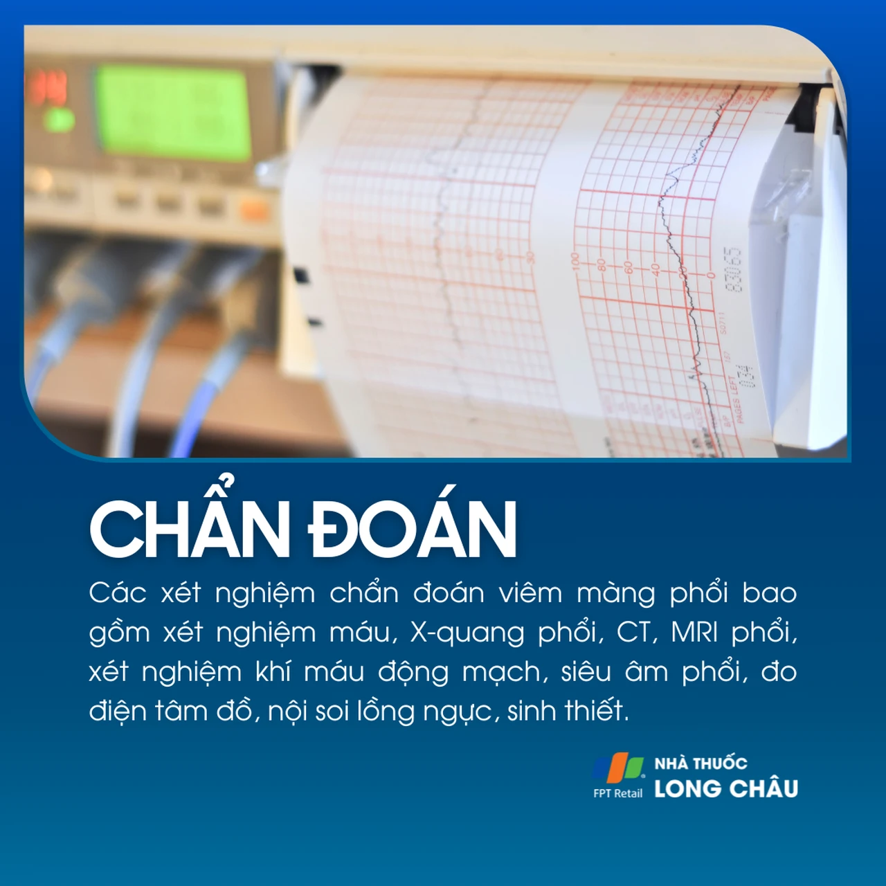 Viêm màng phổi 5
