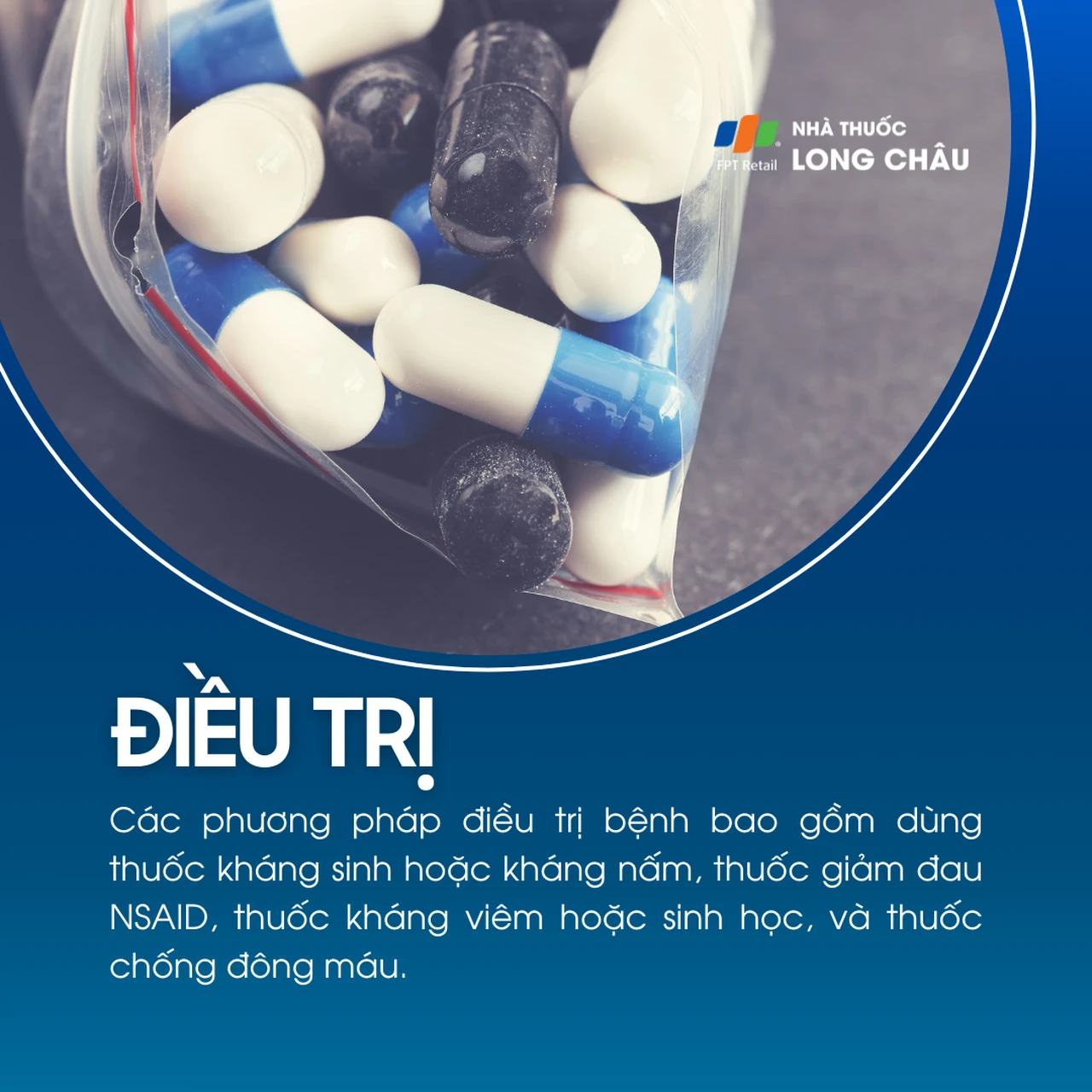 Viêm màng phổi 6