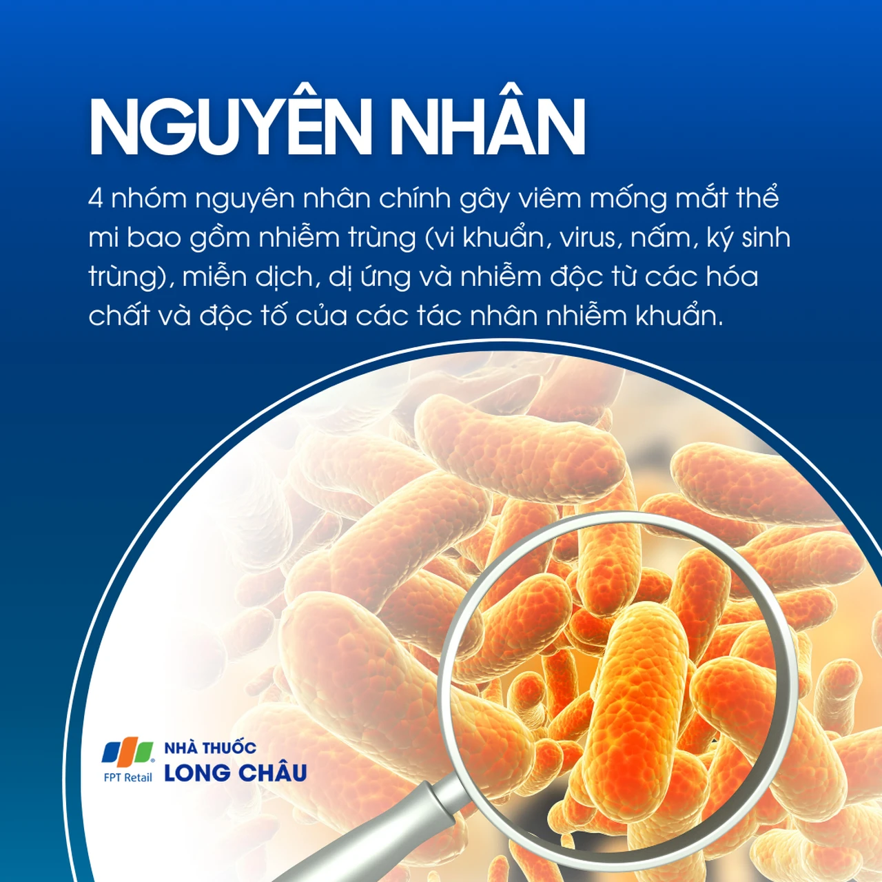 Viêm mống mắt thể mi 3