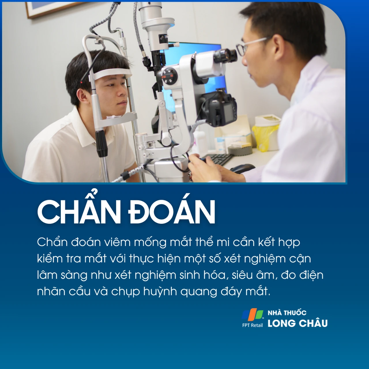 Viêm mống mắt thể mi 5