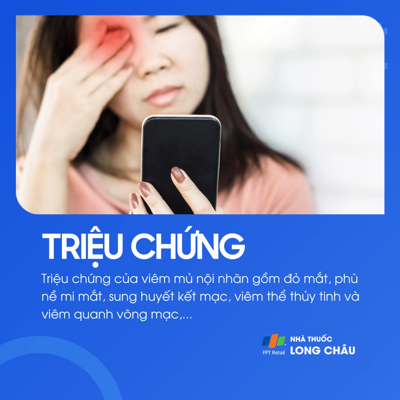 Viêm mủ nội nhãn 2