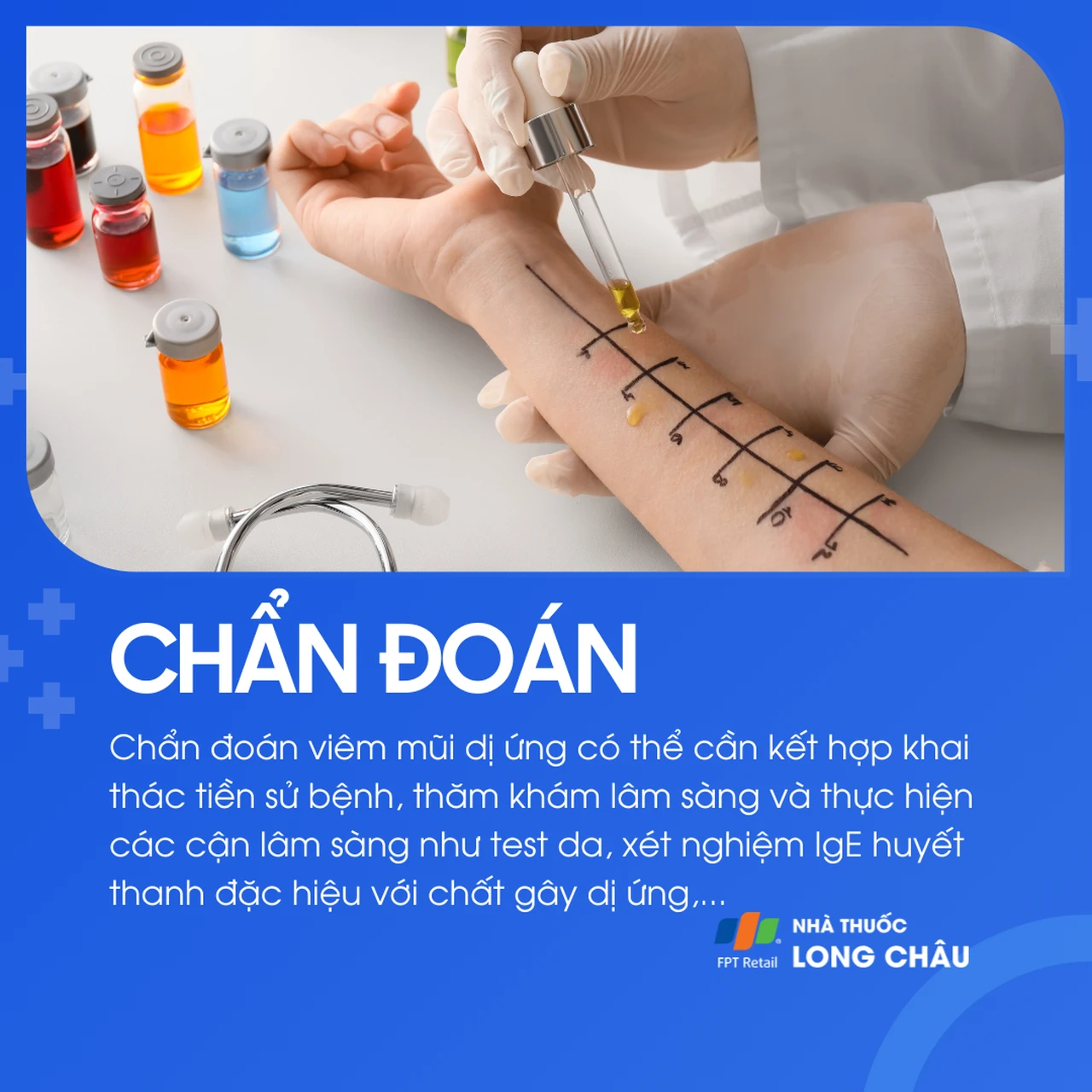 Viêm mũi dị ứng 5