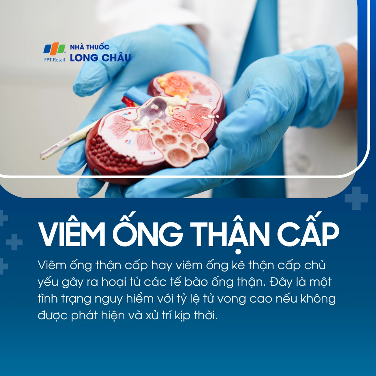 Viêm ống thận cấp 1