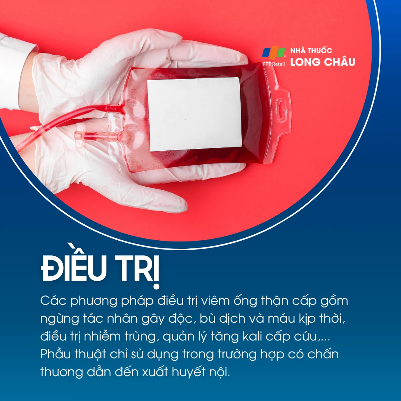 Viêm ống thận cấp 6