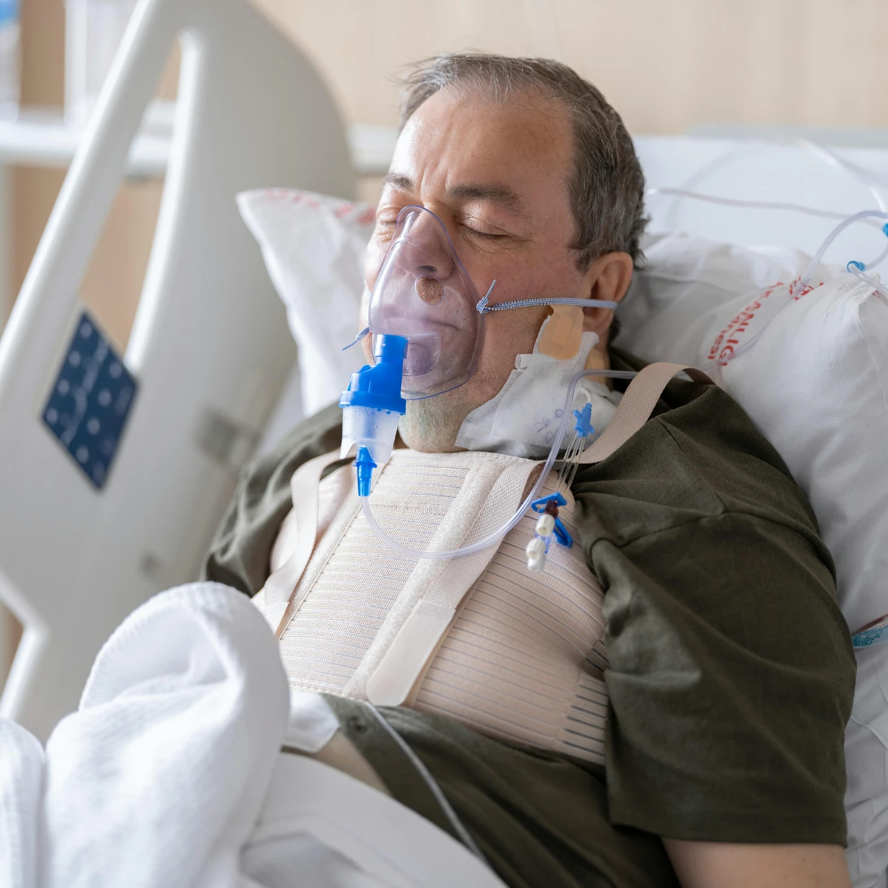 Viêm phổi cộng đồng 3