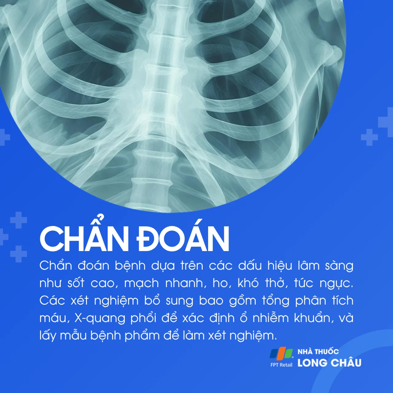 Viêm phổi do tụ cầu 5