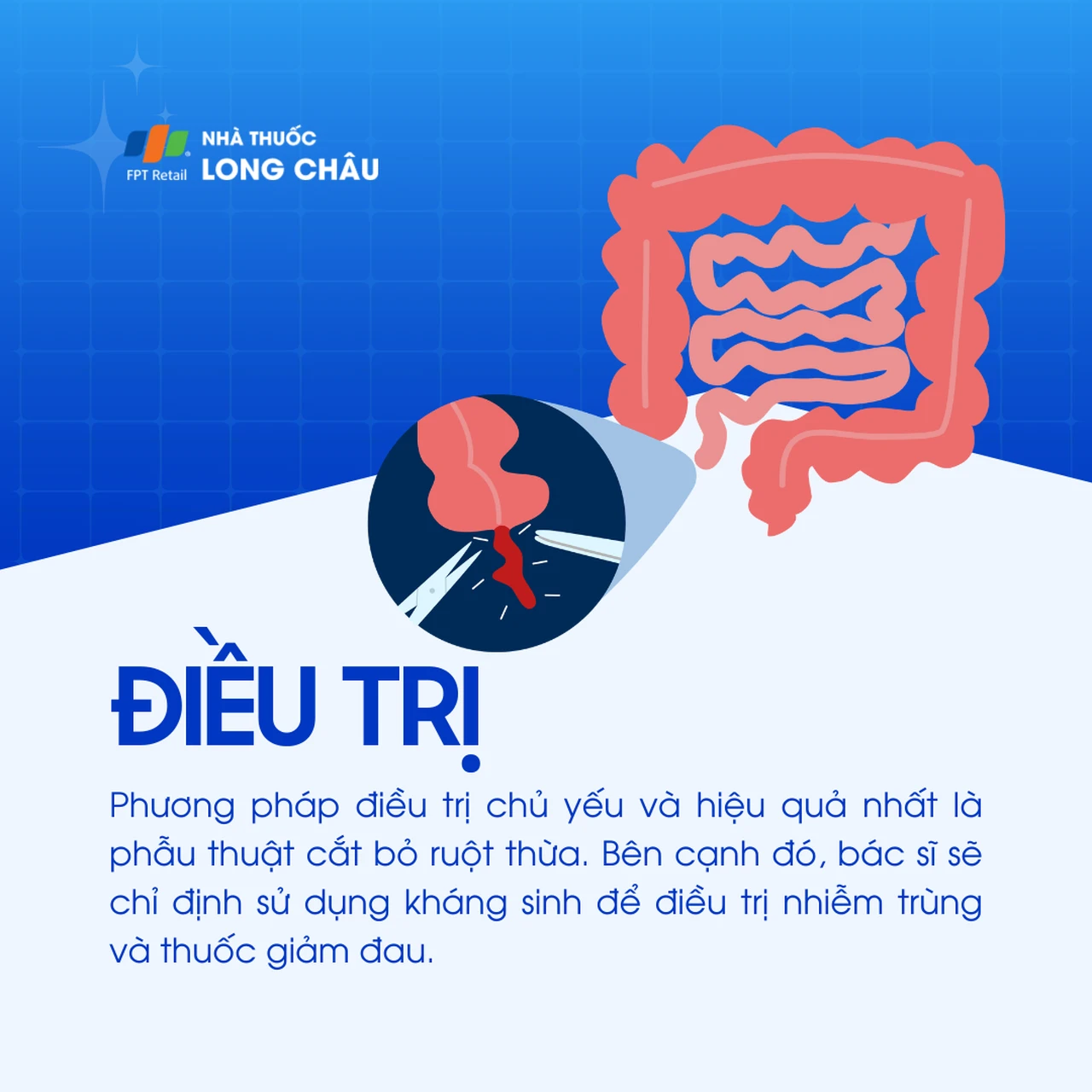 Viêm ruột thừa 6
