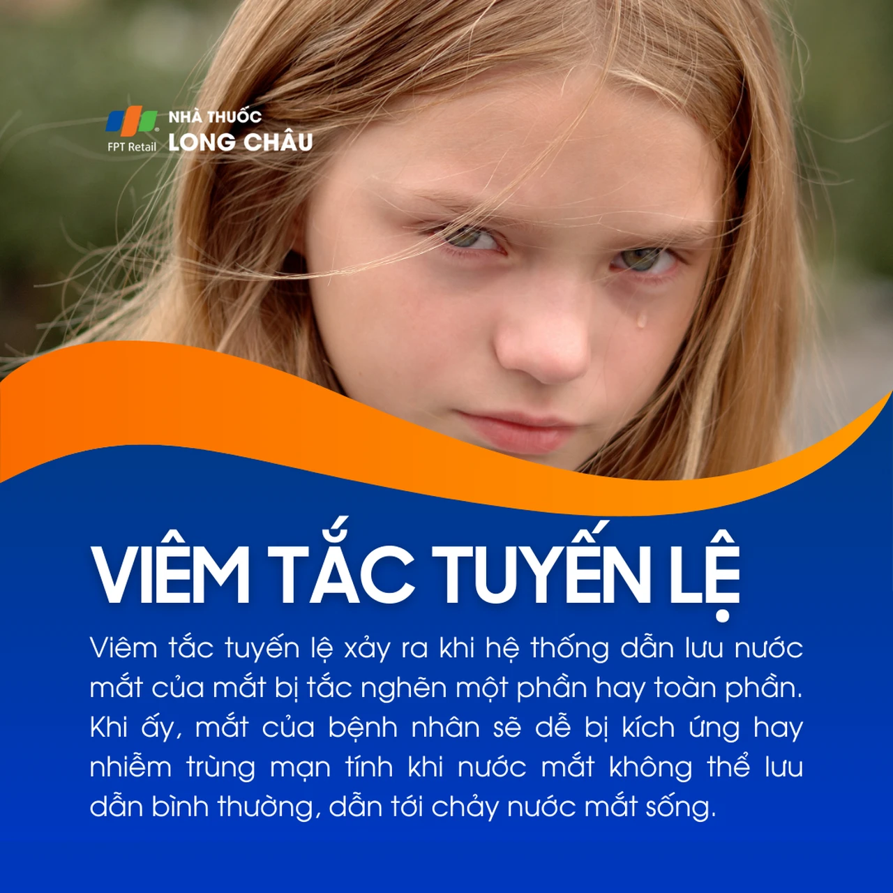 Viêm tắc tuyến lệ 1