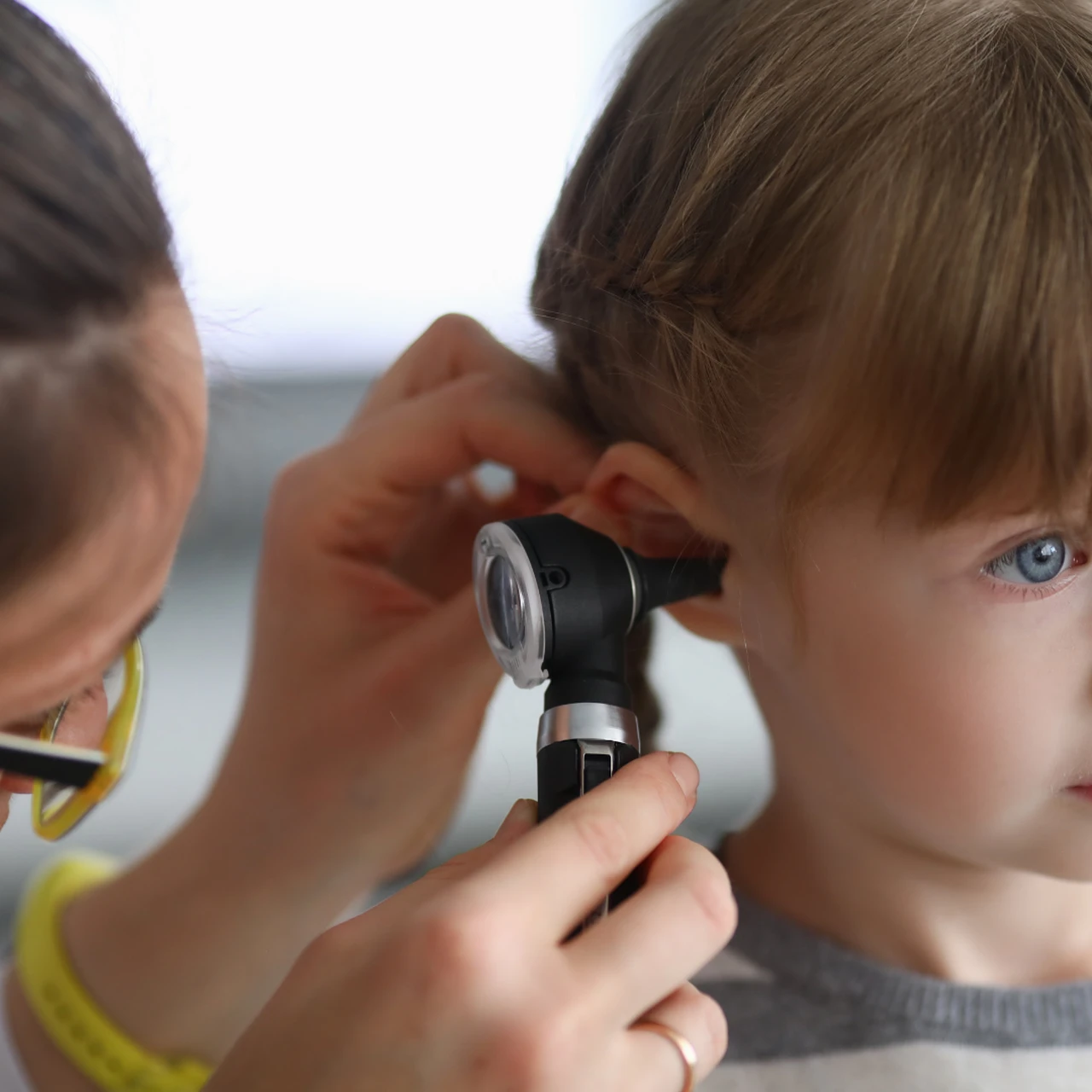 Viêm tai giữa cấp 3