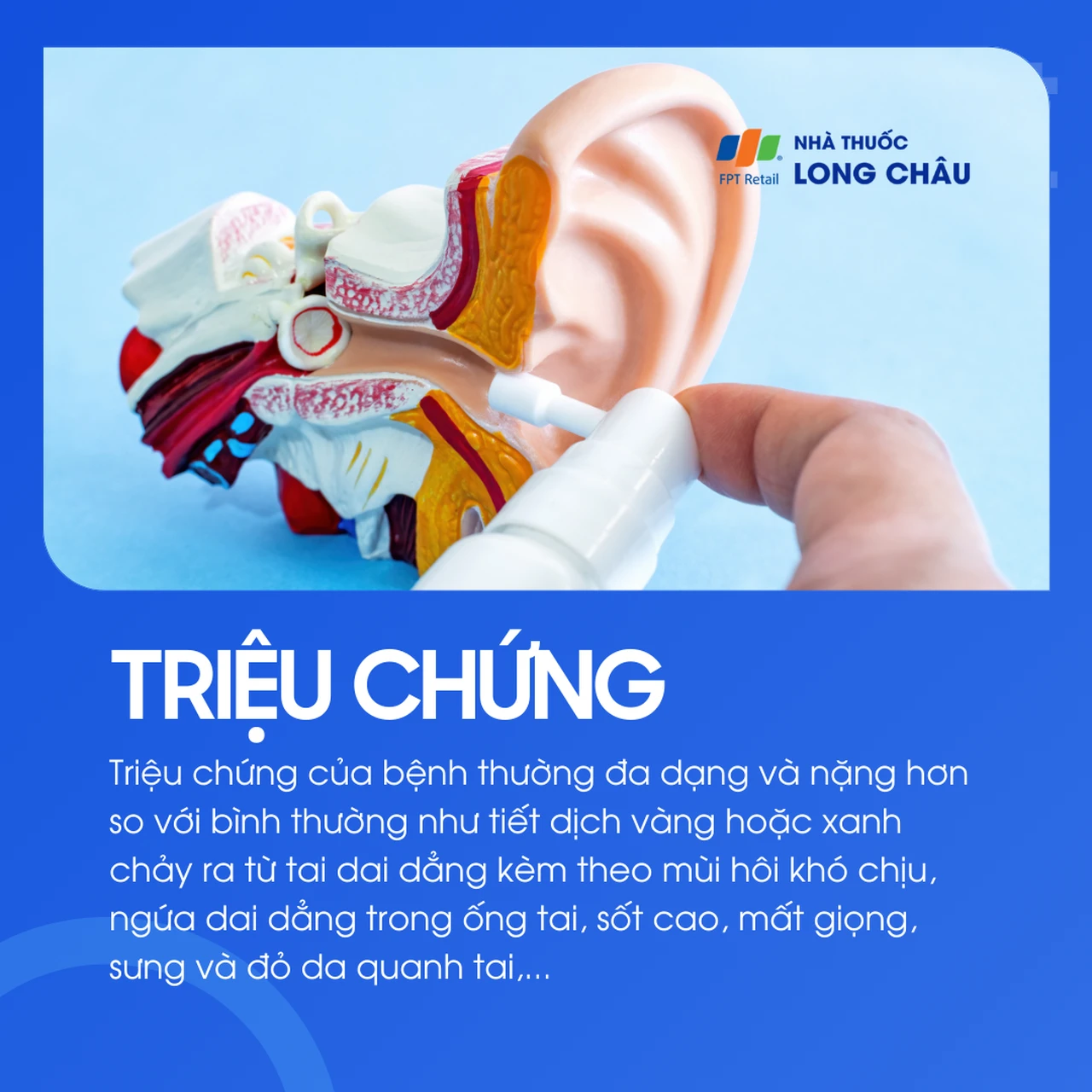 Viêm tai ngoài ác tính 2