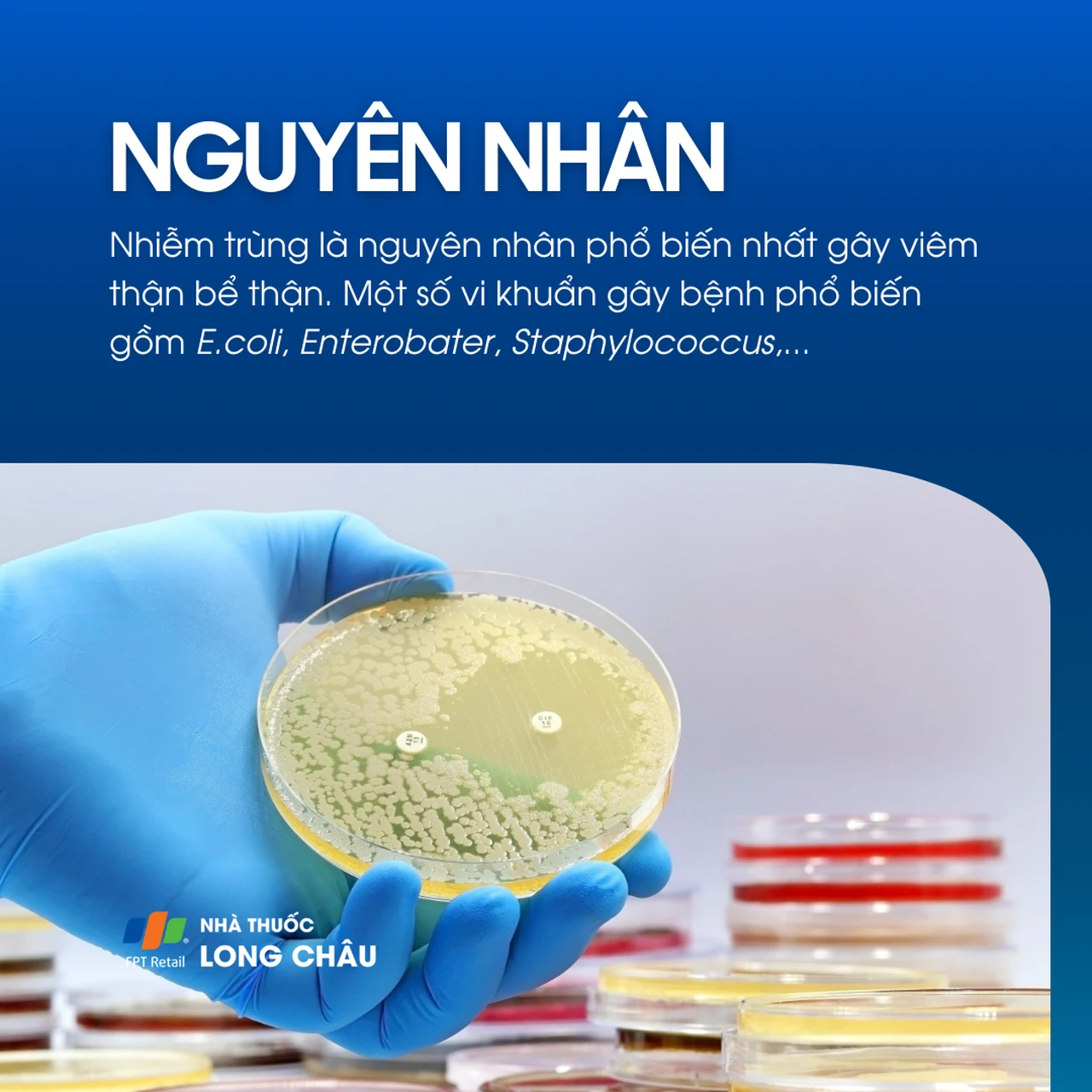 Viêm thận bể thận 3