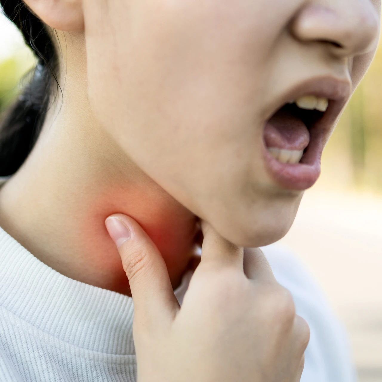 Viêm thanh quản cấp là gì? Những vấn đề cần biết về viêm thanh quản cấp 2