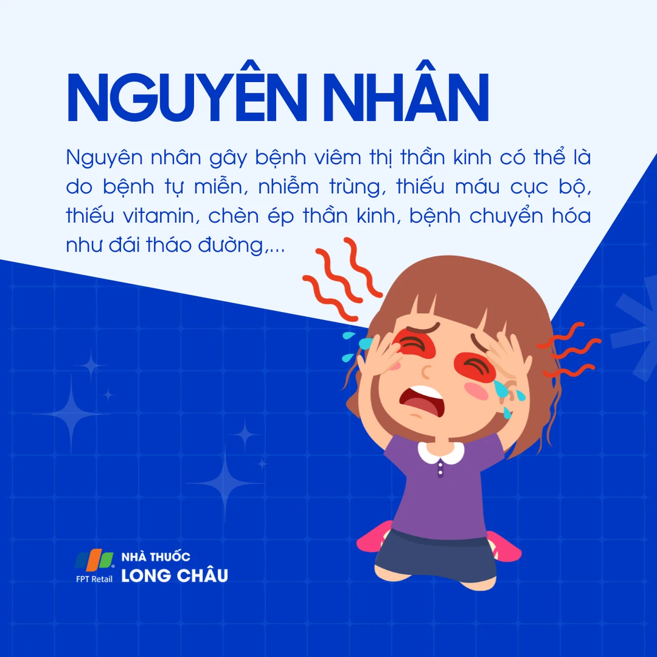 Viêm thị thần kinh 3