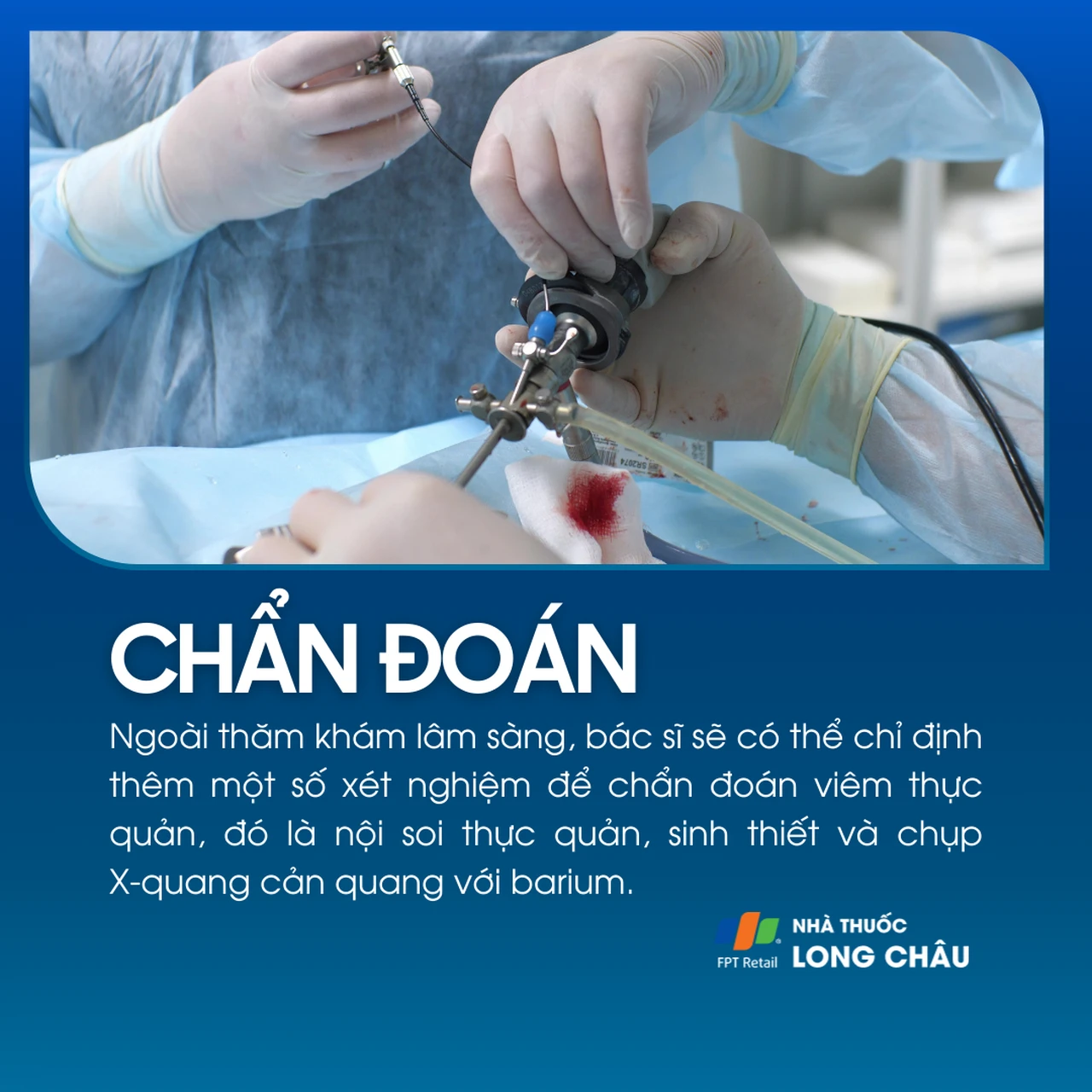 Viêm thực quản 5