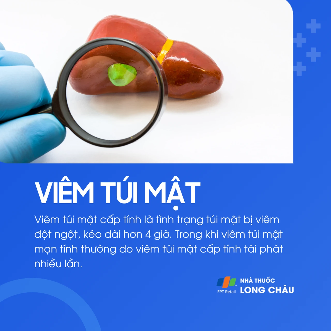 Viêm túi mật 2