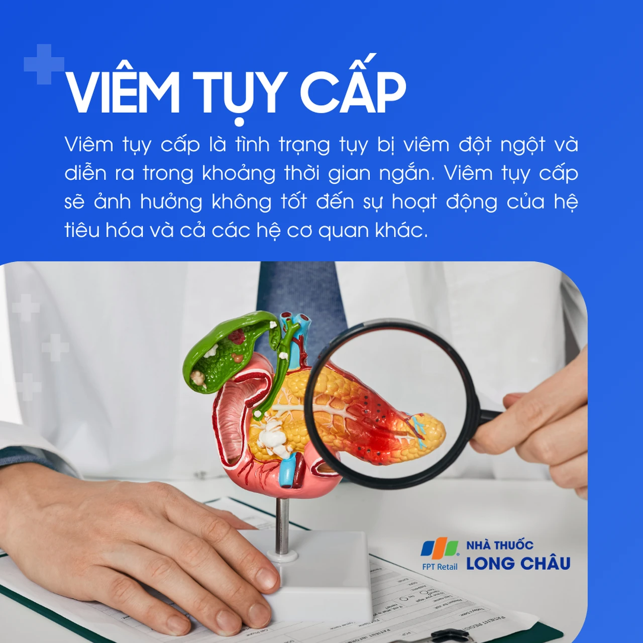 Viêm tụy cấp 1