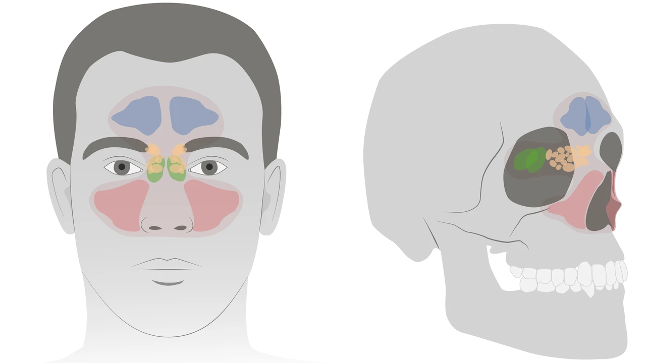 Viêm xoang sàng sau là gì? Những vấn đề cần biết về viêm xoang sàng sau 2