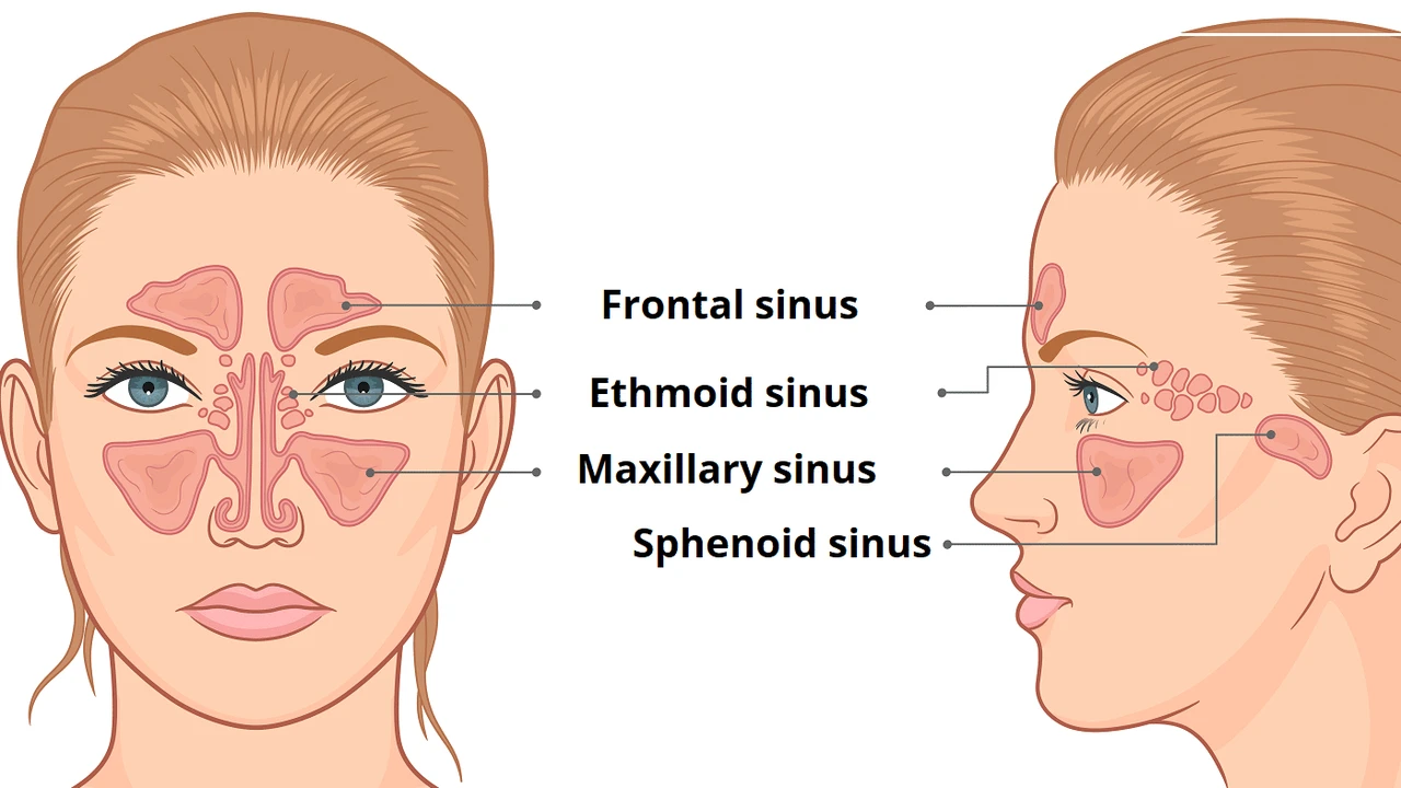 Viêm xoang sàng sau là gì? Những vấn đề cần biết về viêm xoang sàng sau 3