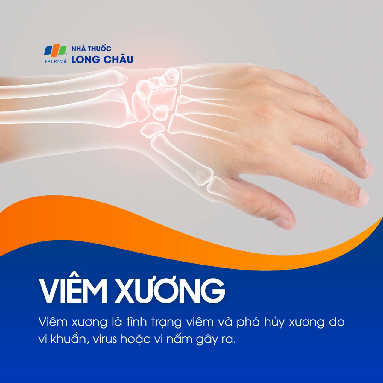 Viêm xương 1