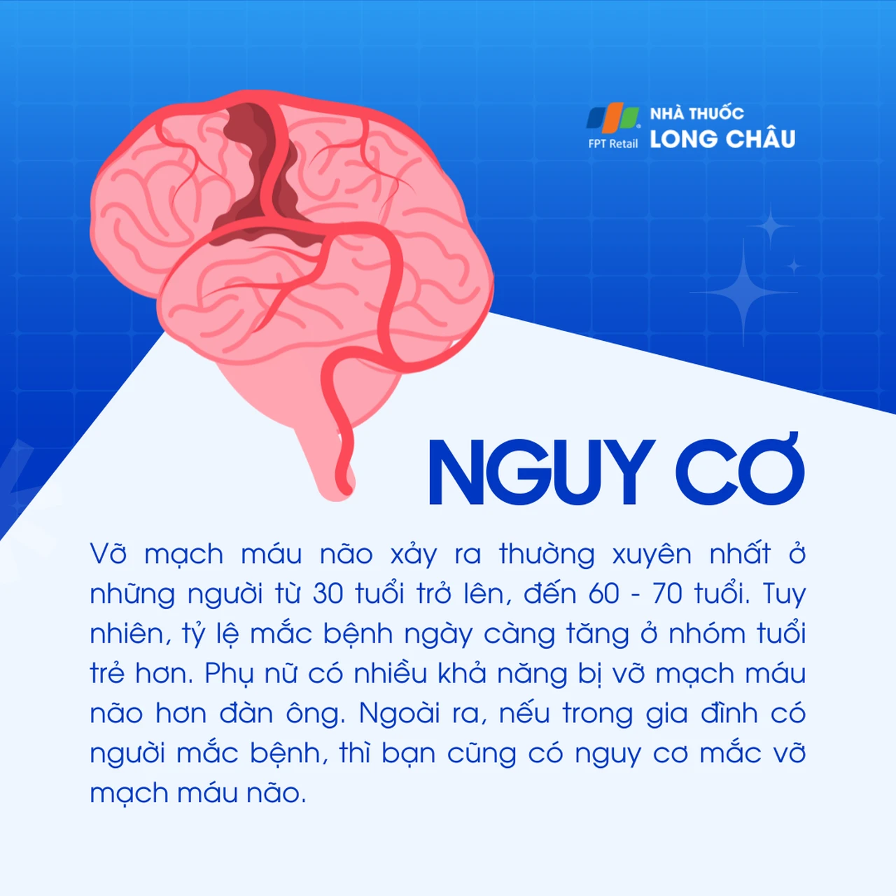 Vỡ mạch máu não 4