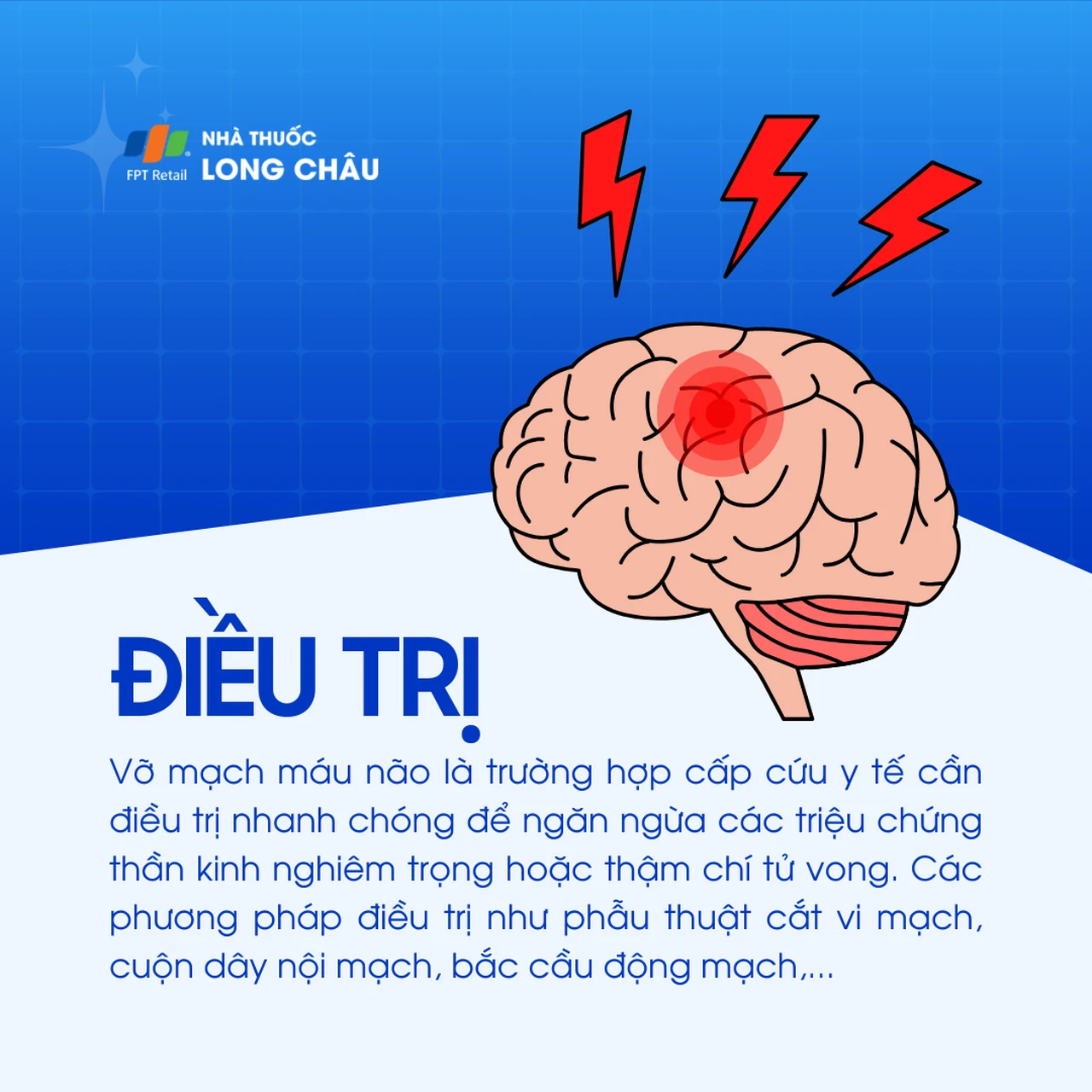 Vỡ mạch máu não 6