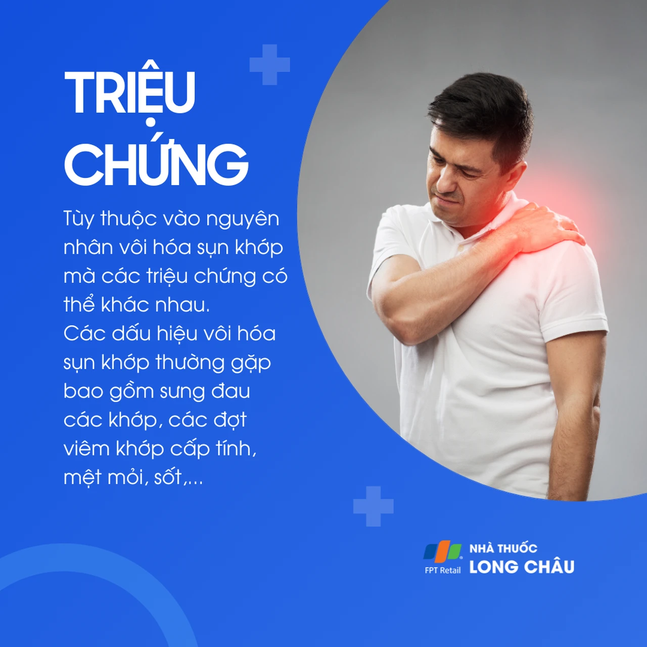 Vôi hóa sụn khớp 2