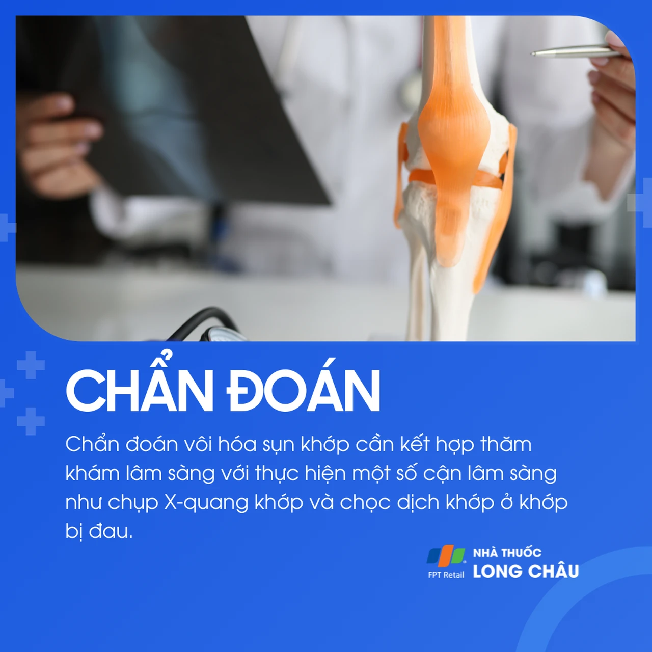 Vôi hóa sụn khớp 5