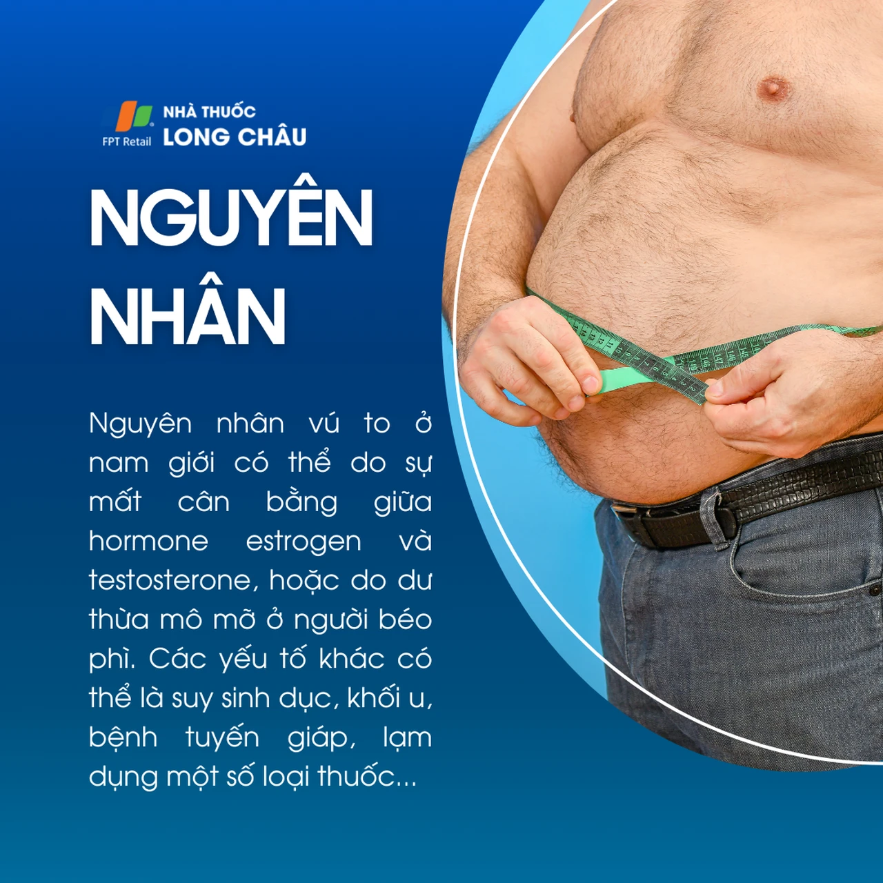 Vú to ở nam giới 3