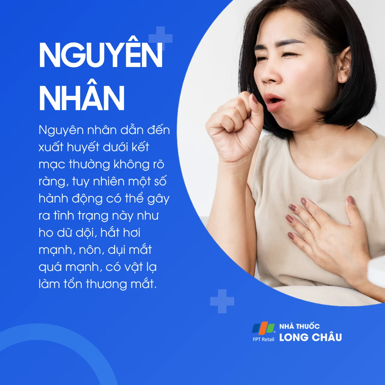 Xuất huyết dưới kết mạc 3