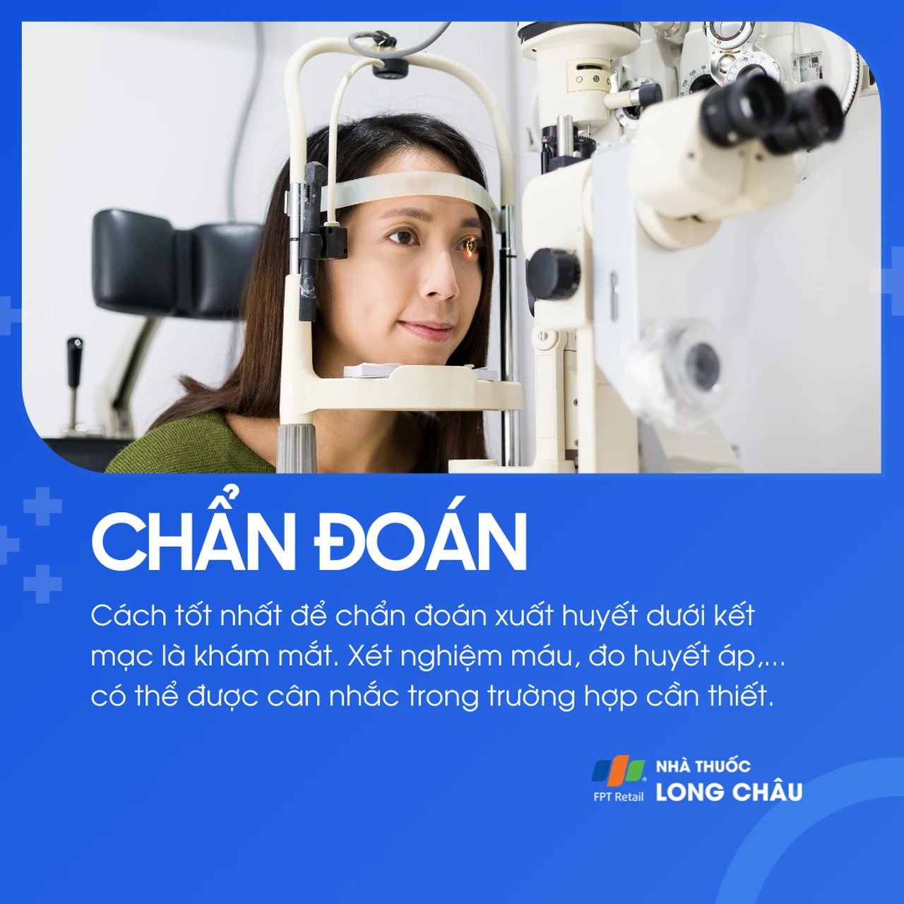 Xuất huyết dưới kết mạc 5