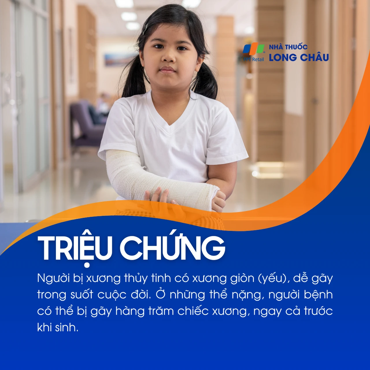 Xương thủy tinh 2