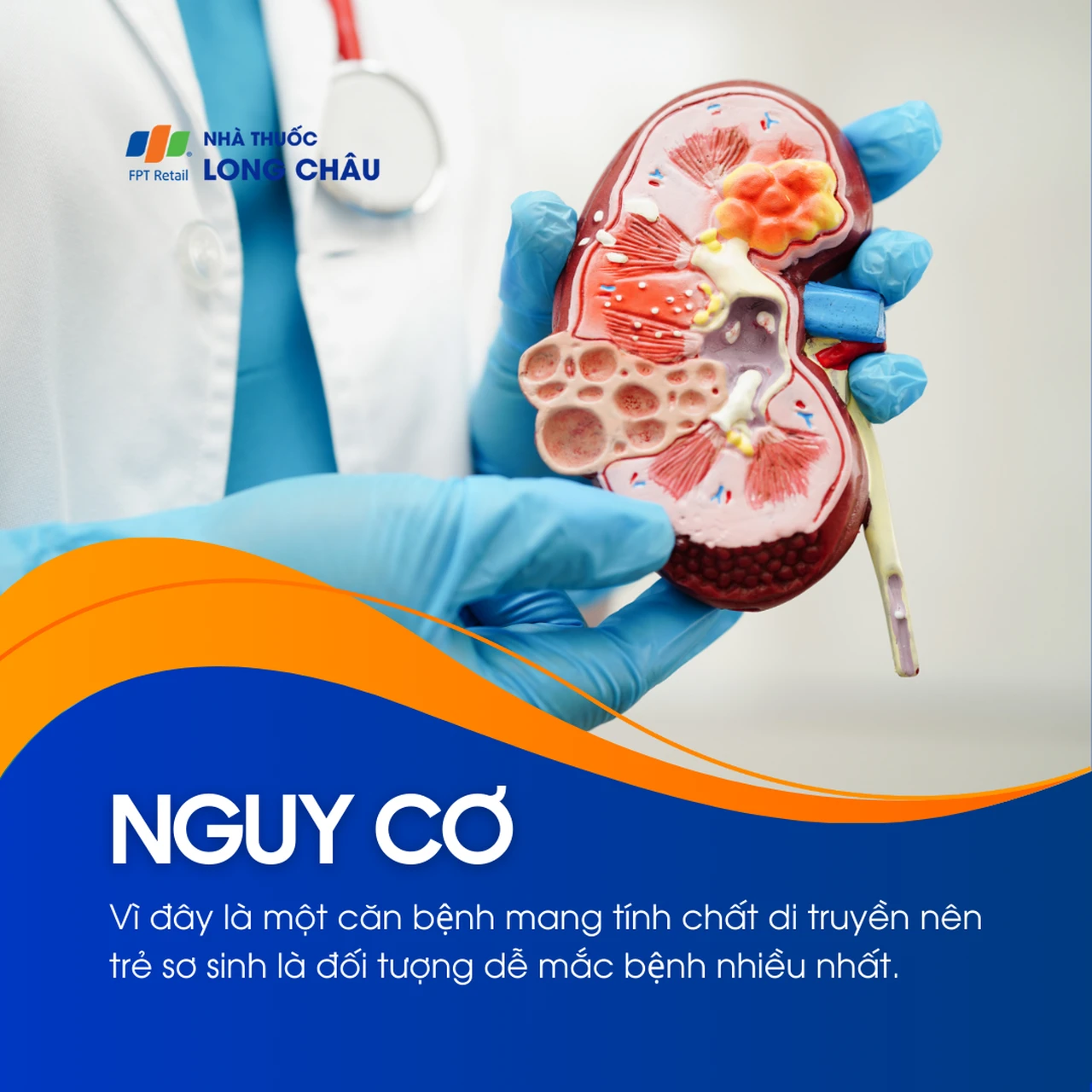 Xương thủy tinh 4