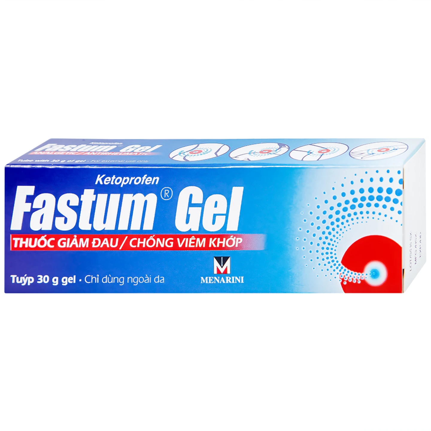 Thuốc Fastum Gel 30g giảm đau và chống viêm xương khớp