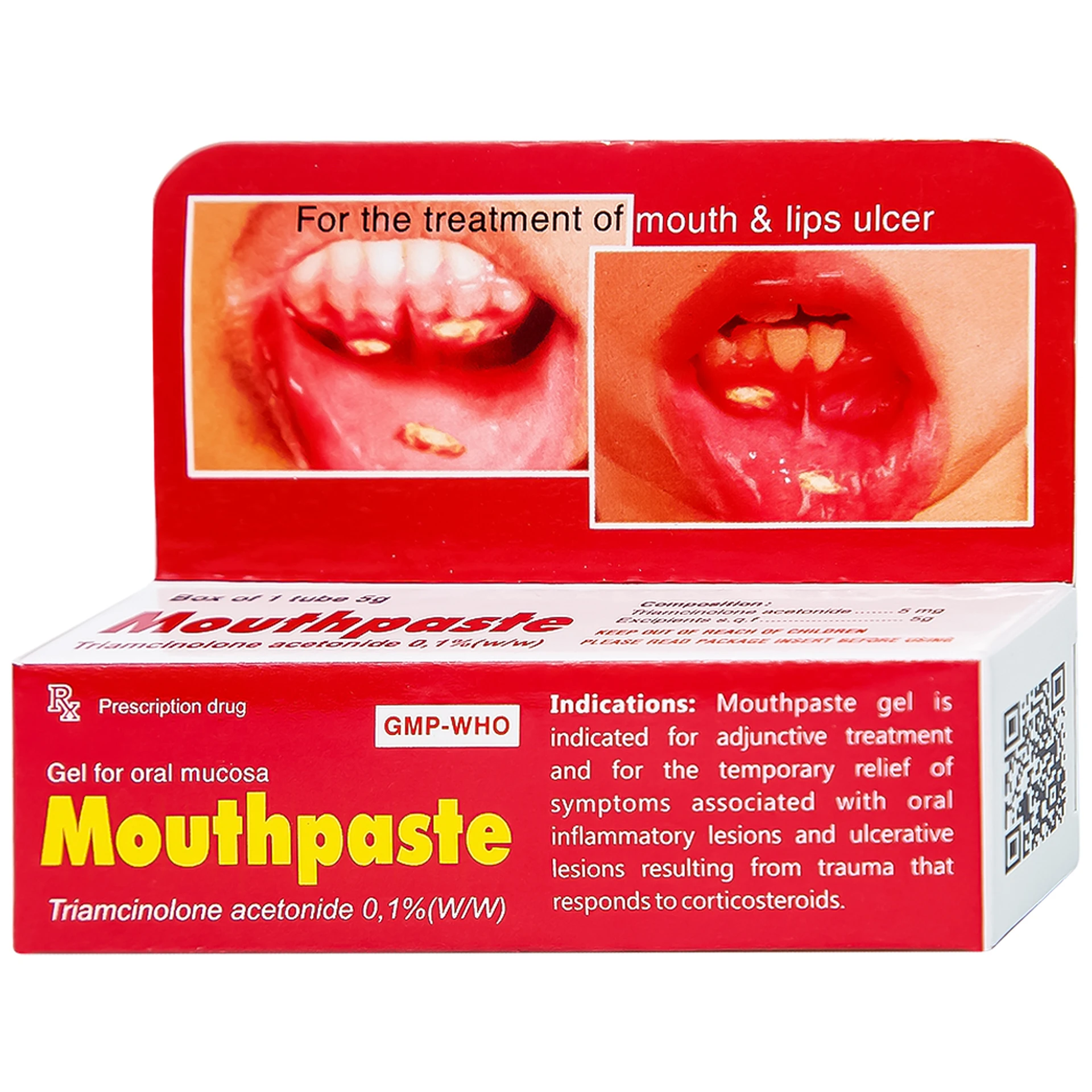 Thuốc Mouthpaste giảm tổn thương ở niêm mạc miệng, lợi (5g)
