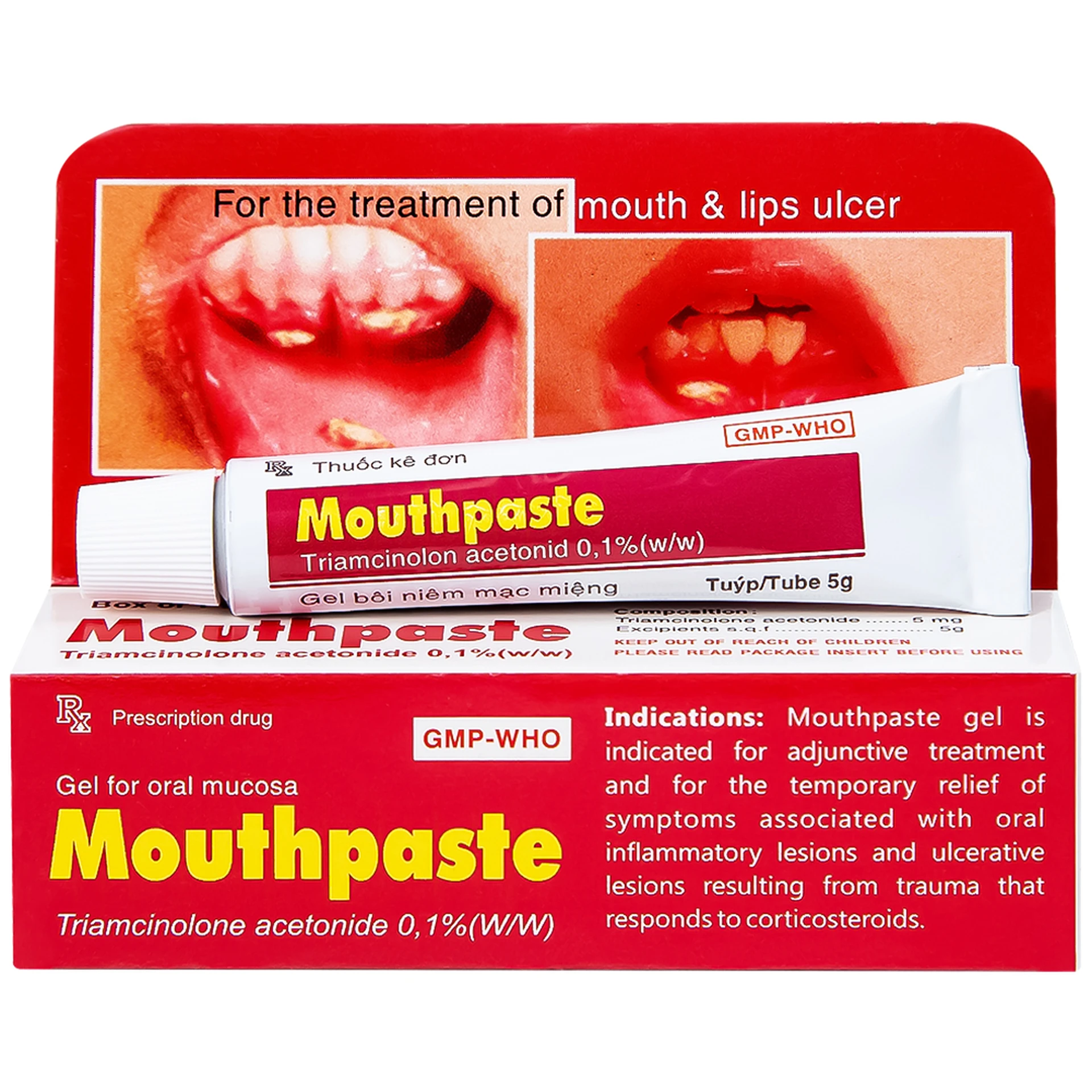 Thuốc Mouthpaste giảm tổn thương ở niêm mạc miệng, lợi (5g)