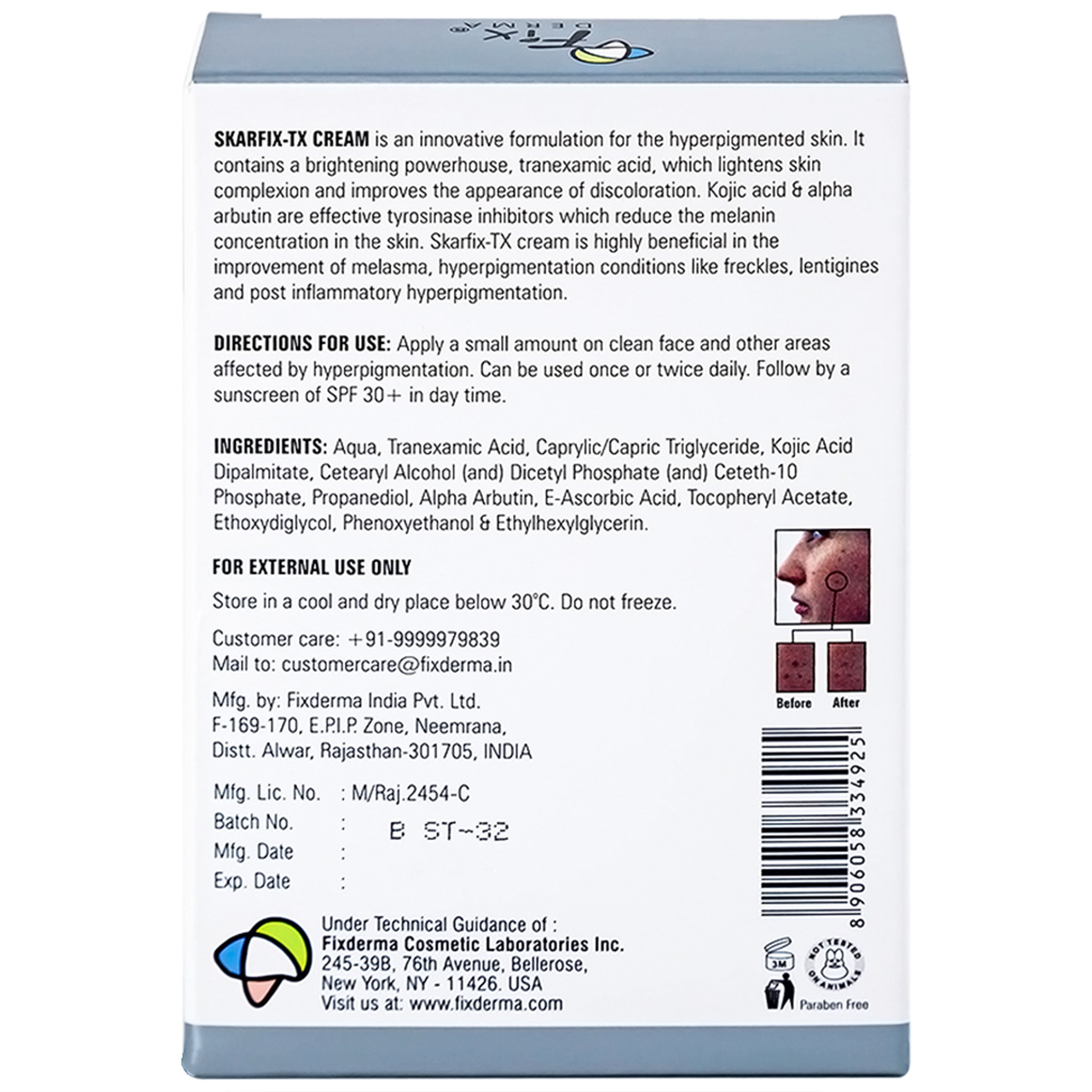 Kem bôi ngừa nám, tàn nhang Fixderma Skarfix TX cream 15g