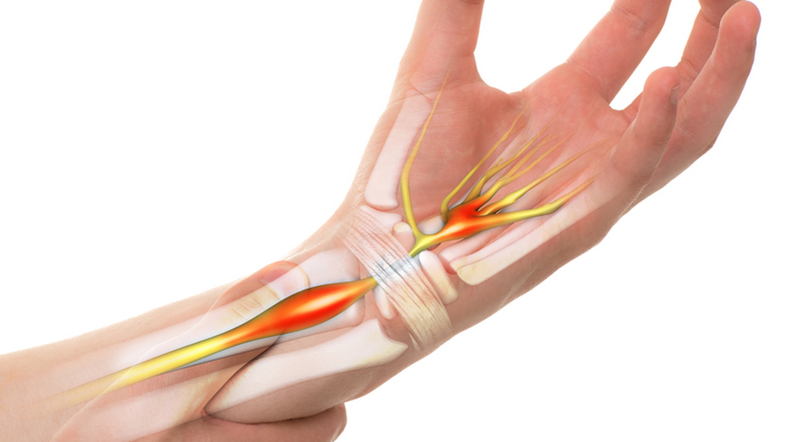 Tay bị đau nhức trong xương là bệnh gì? 3