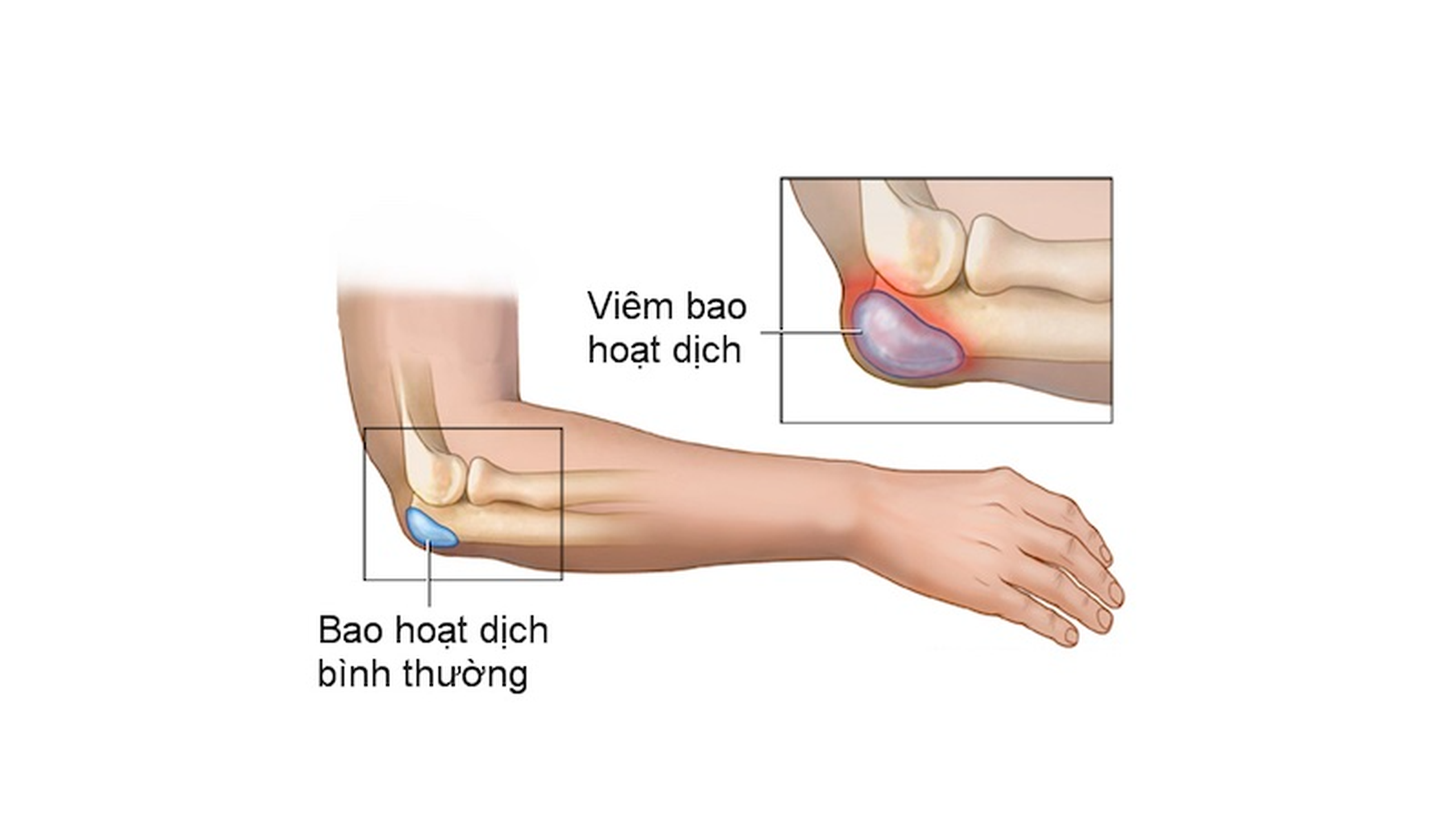 Bao hoạt dịch là gì? Và những điều cần biết về bao hoạt dịch