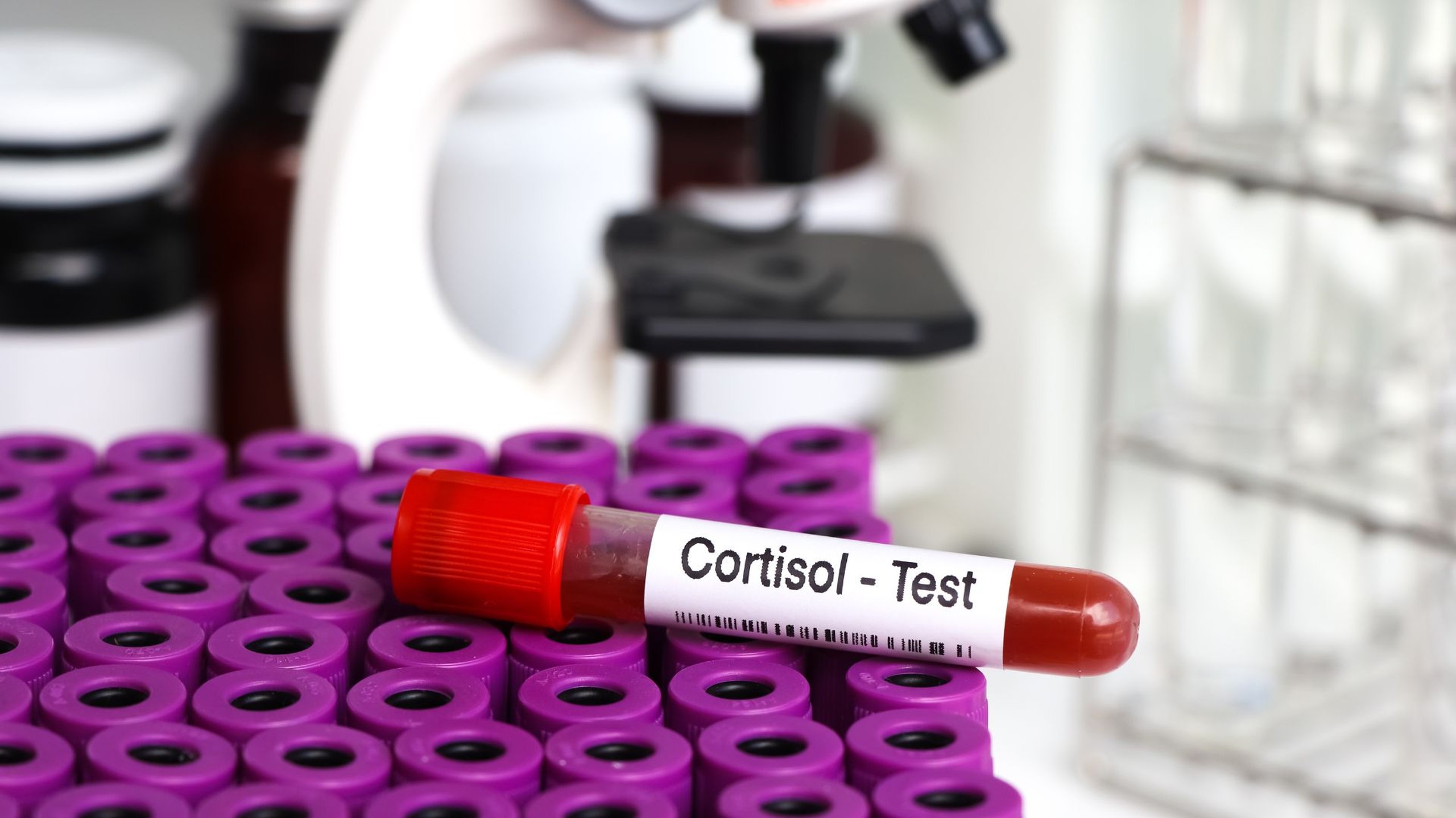 Bướu trâu là gì: nguyên nhân, triệu chứng và cách điều trị hiệu quả-3