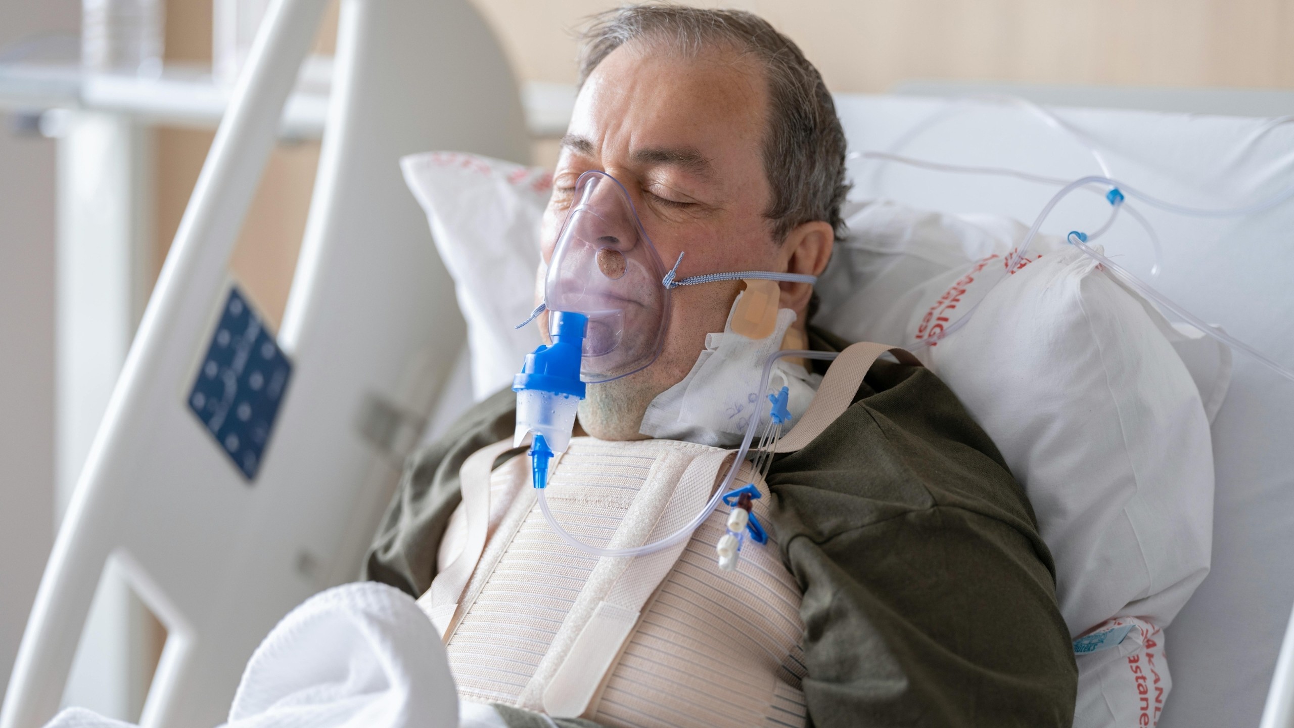 Biến chứng suy hô hấp: Nguyên nhân, hậu quả và cách phòng ngừa hiệu quả 1