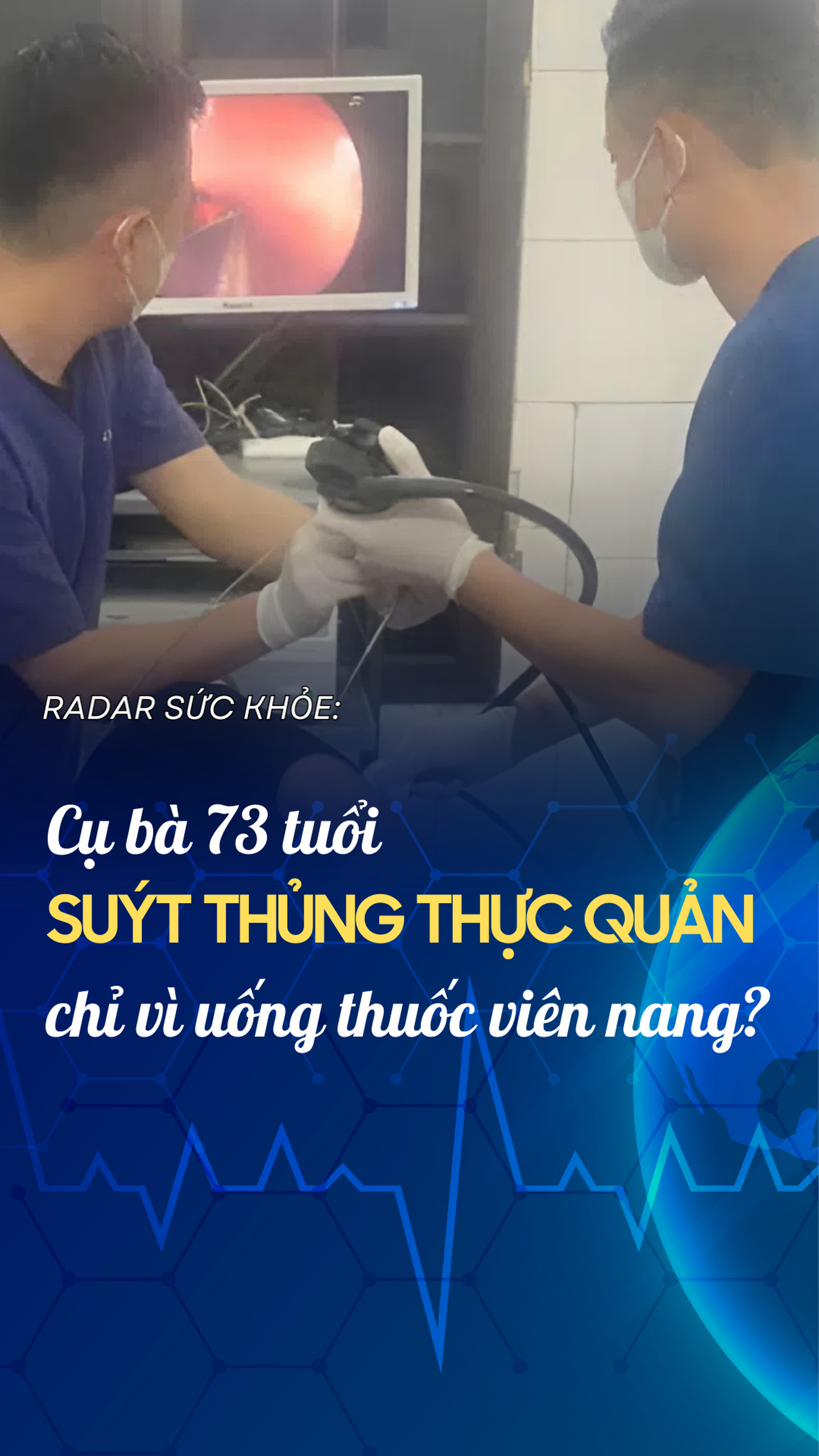 Cụ bà 73 tuổi suýt thủng thực quản chỉ vì uống thuốc viên nang?