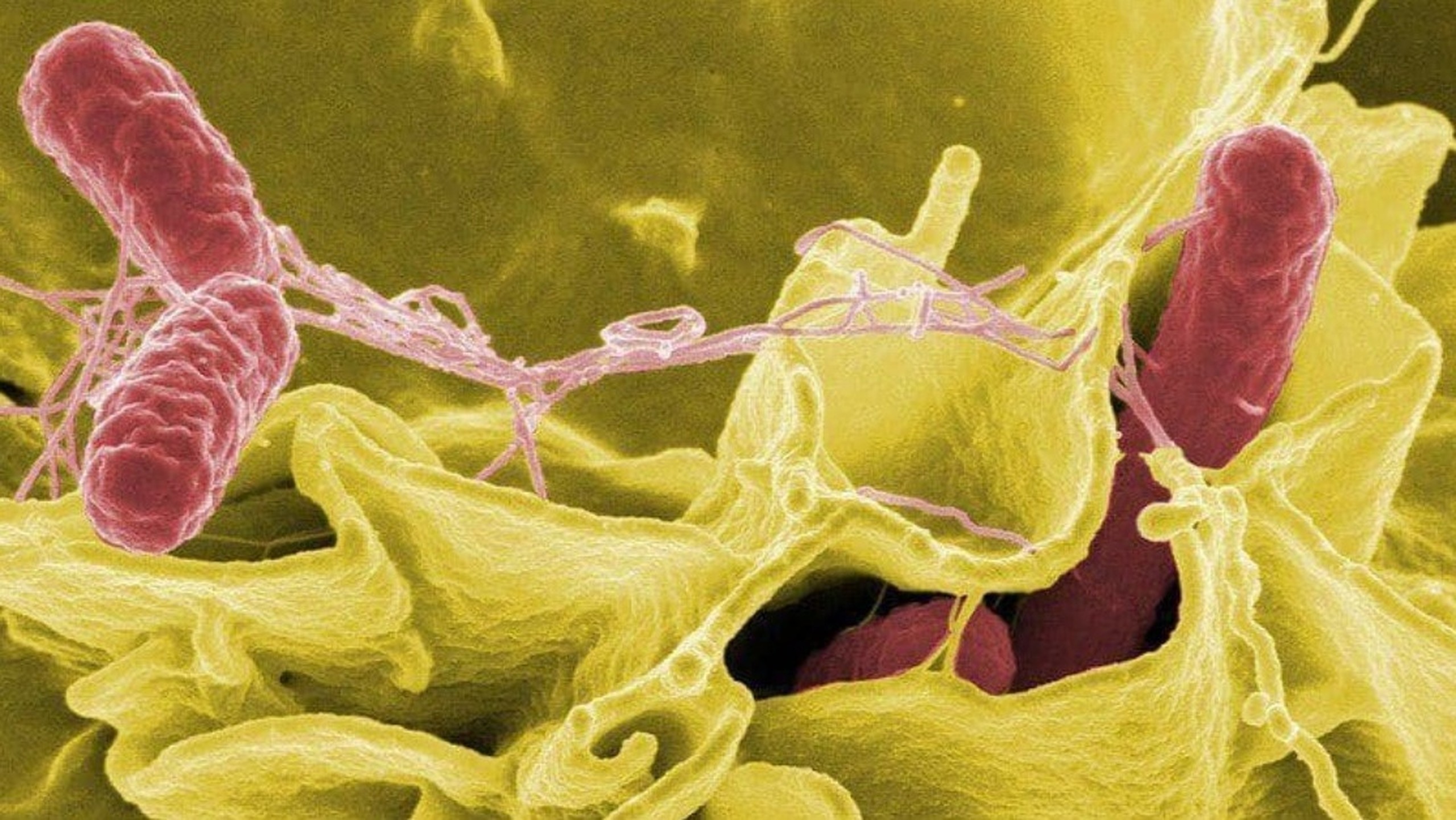 Đâu là những tác nhân gây bệnh thương hàn bạn cần biết?