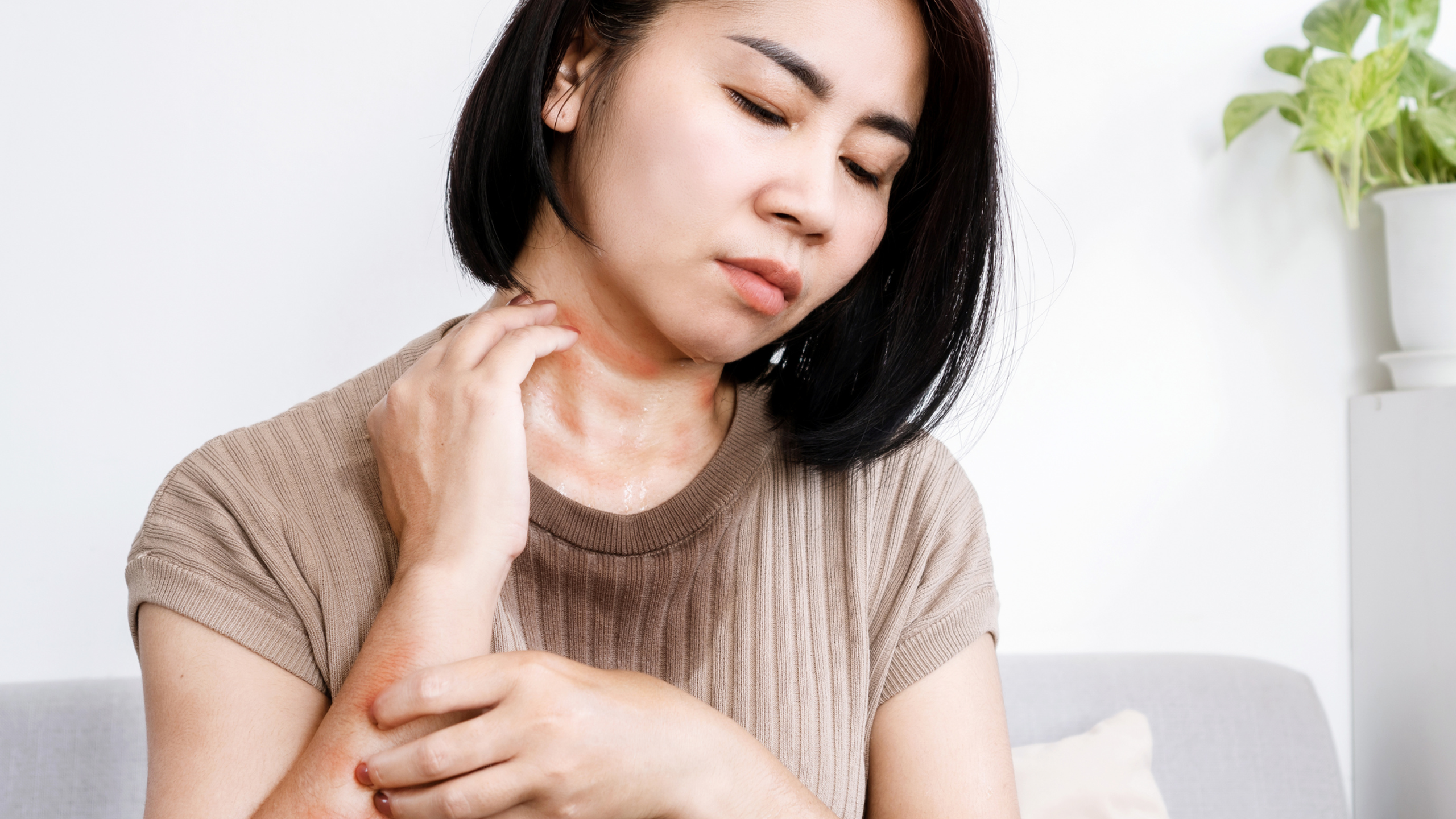 Cẩn trọng với các bệnh da liễu thường gặp khi thời tiết nồm ẩm