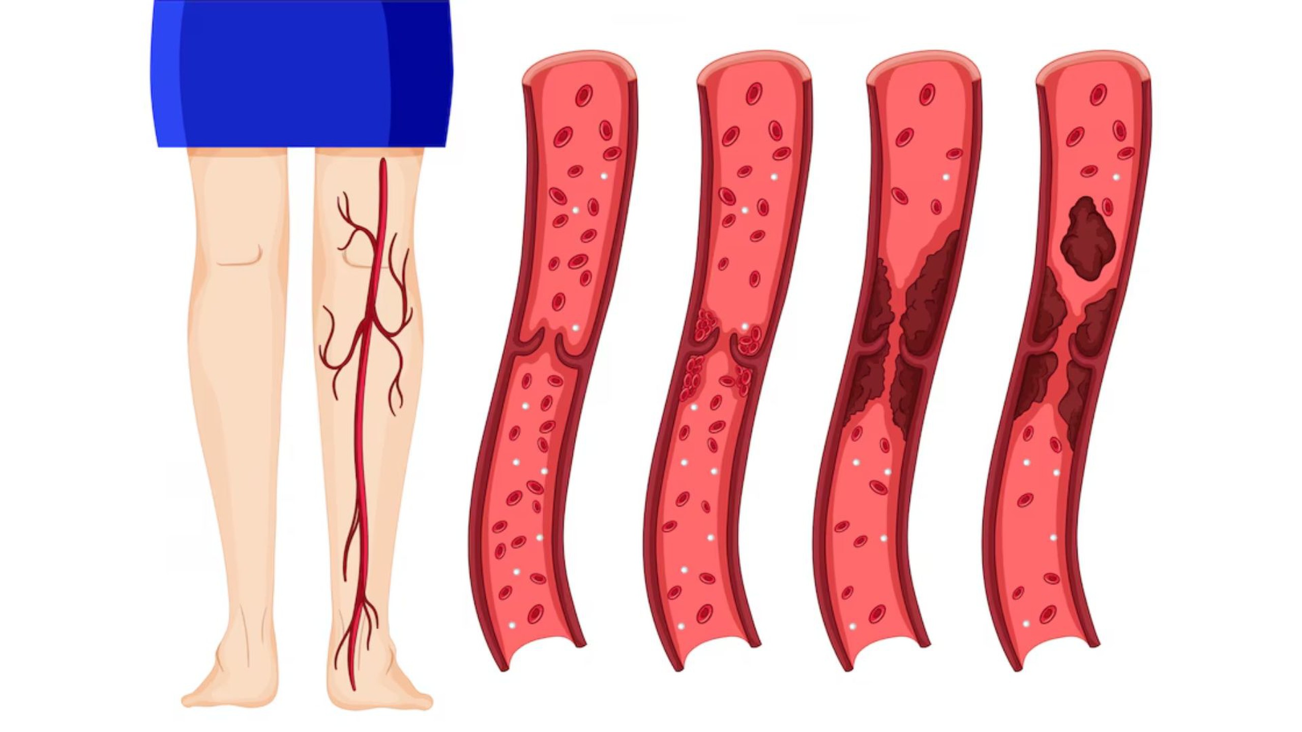 Động mạch chày trước: Cấu tạo, chức năng và những bệnh lý thường gặp