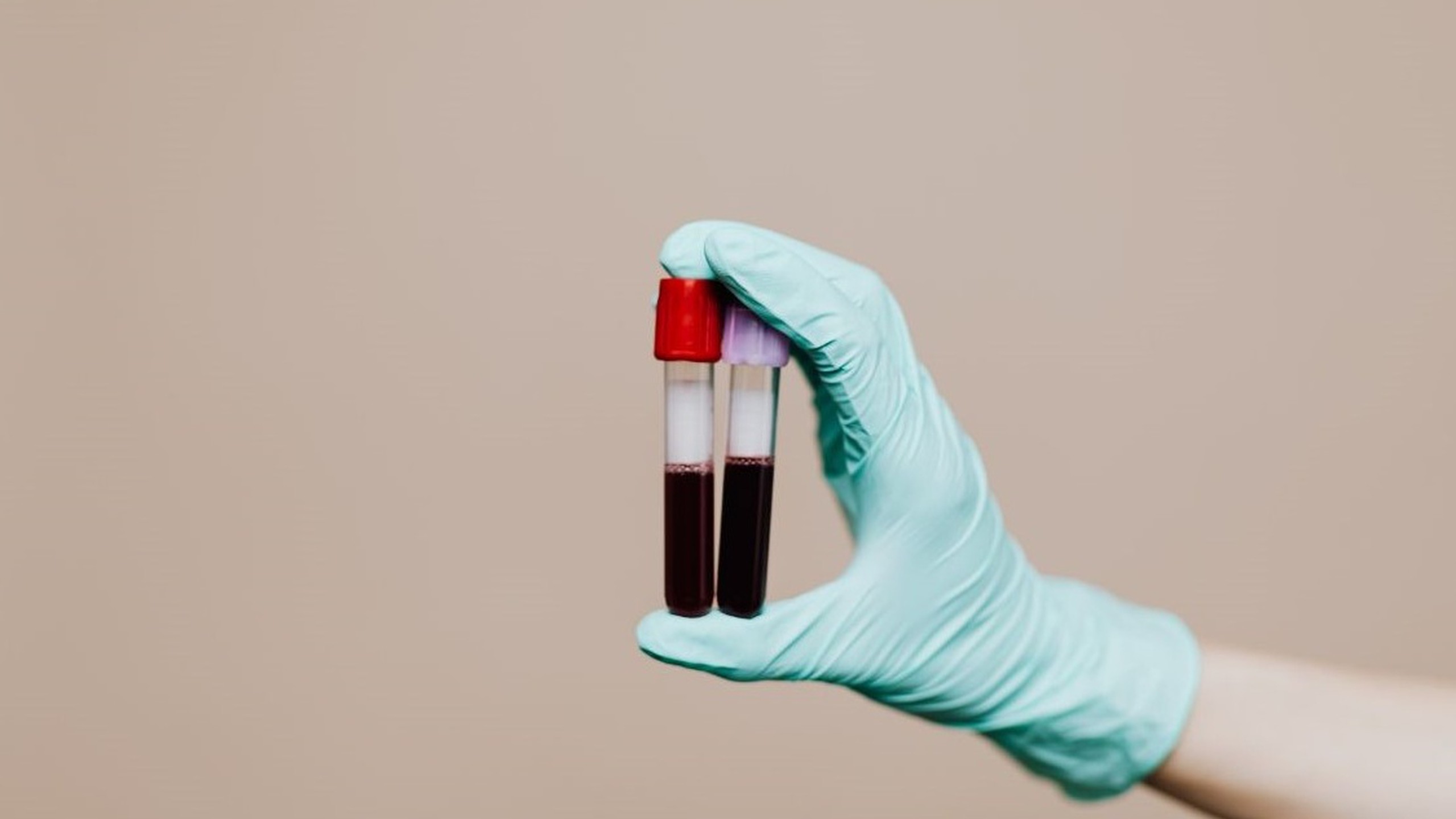 Hiến máu có được xét nghiệm hiv không? Những điều cần biết về hiến máu