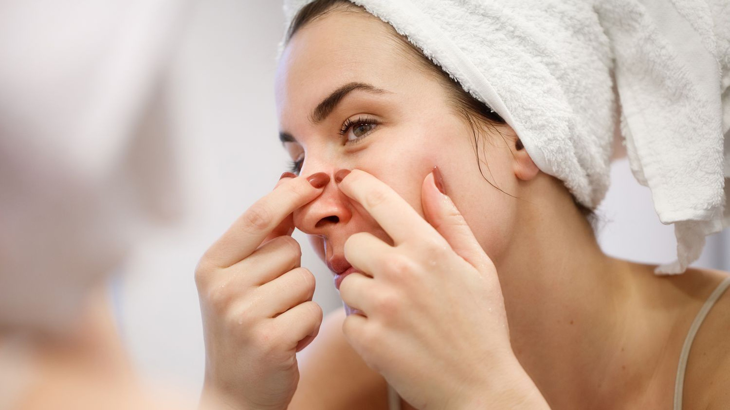 Lấy nhân mụn có hết mụn không? Chăm sóc đúng cách sau nặn mụn