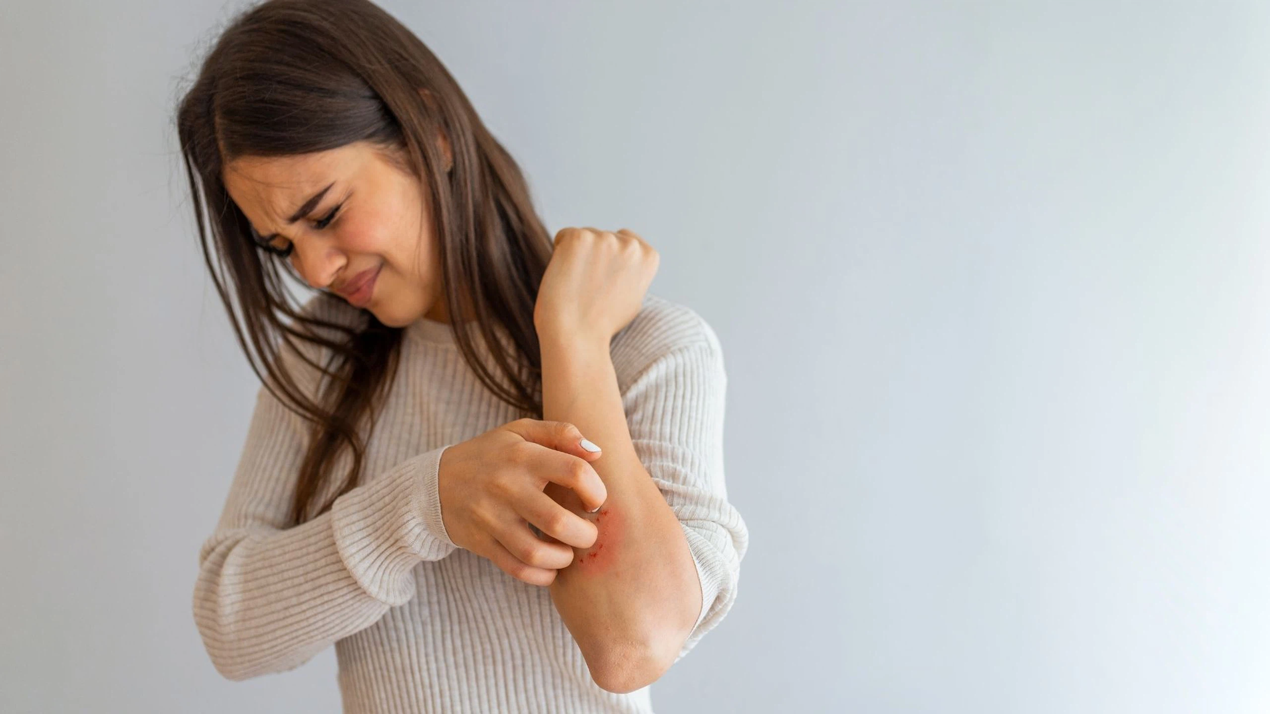 Viêm da tiếp xúc và viêm da cơ địa: Cách phân biệt và hướng xử trí hiệu quả 1