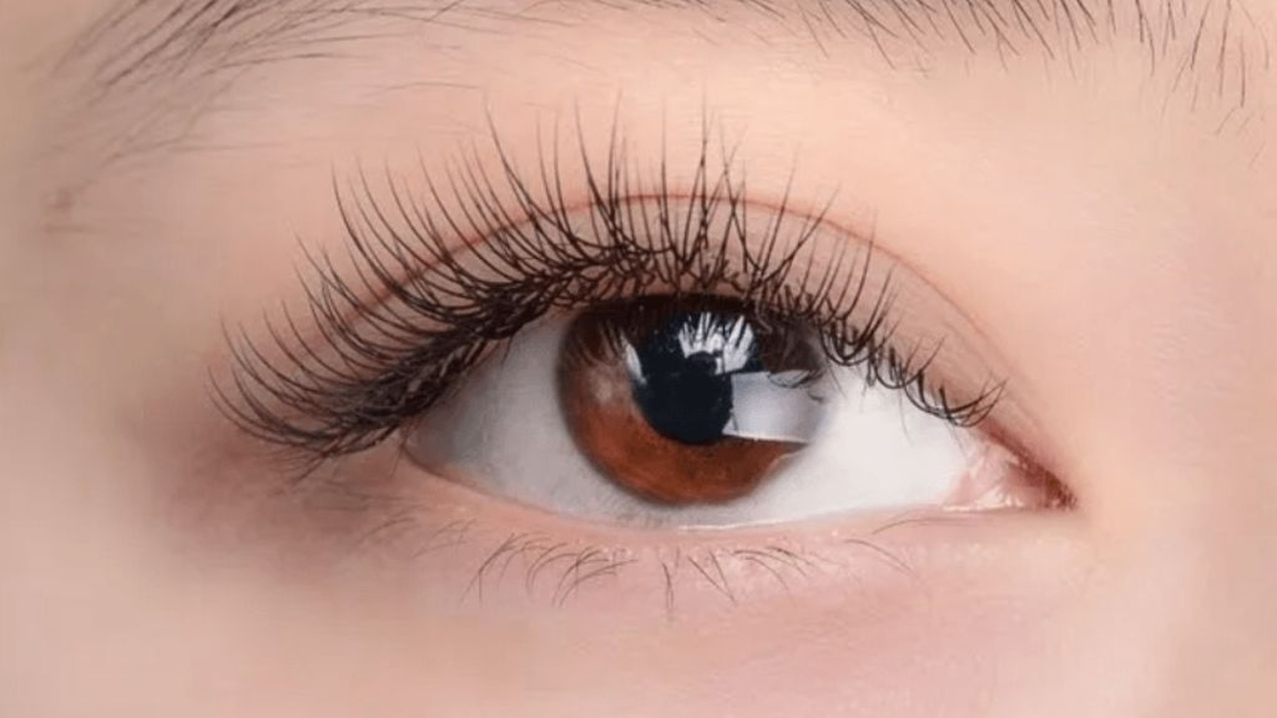 Lông mi mọc ngược và những điều cần biết 0