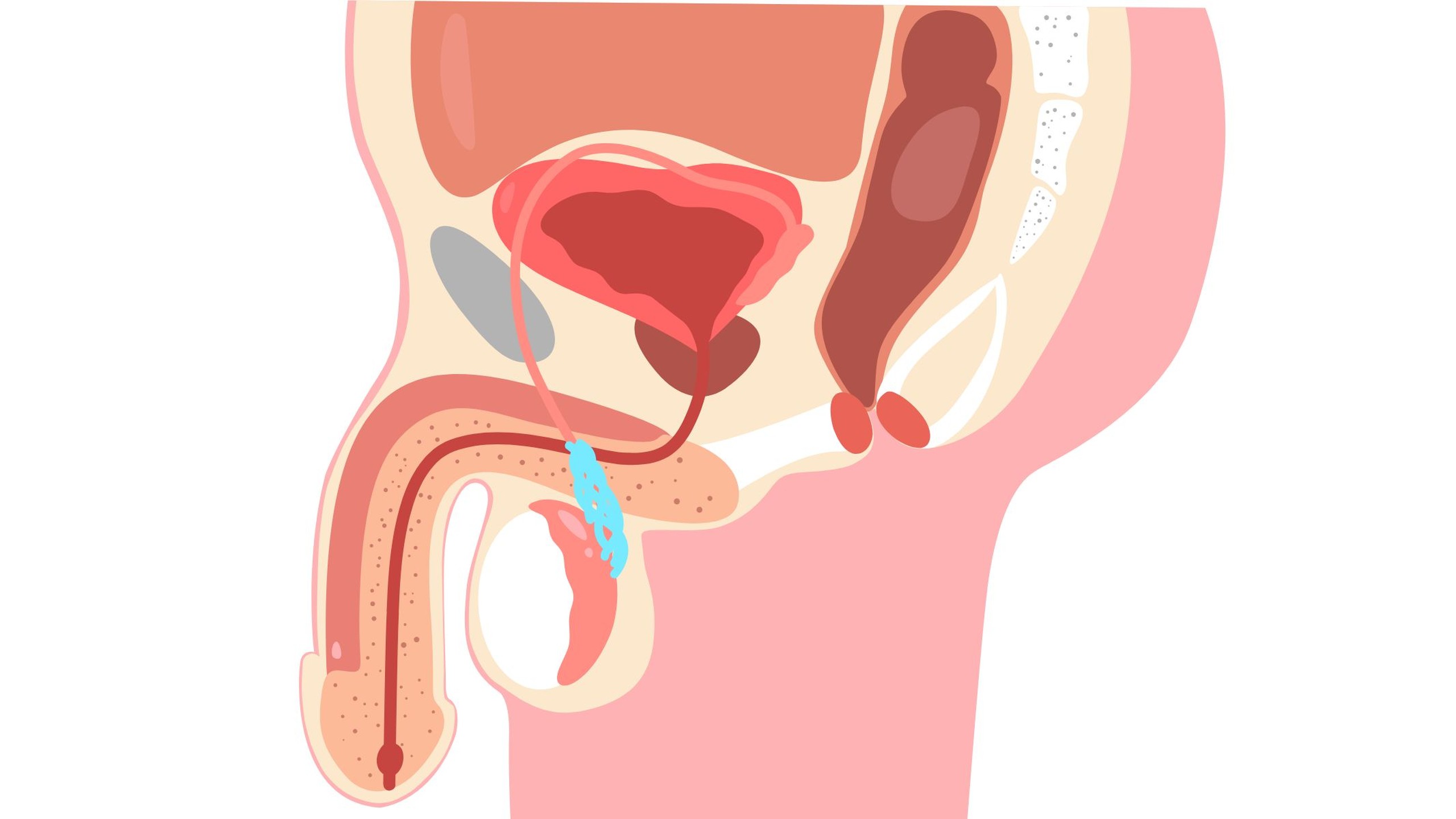Nguyên nhân giãn tĩnh mạch thừng tinh là gì? Cách điều trị