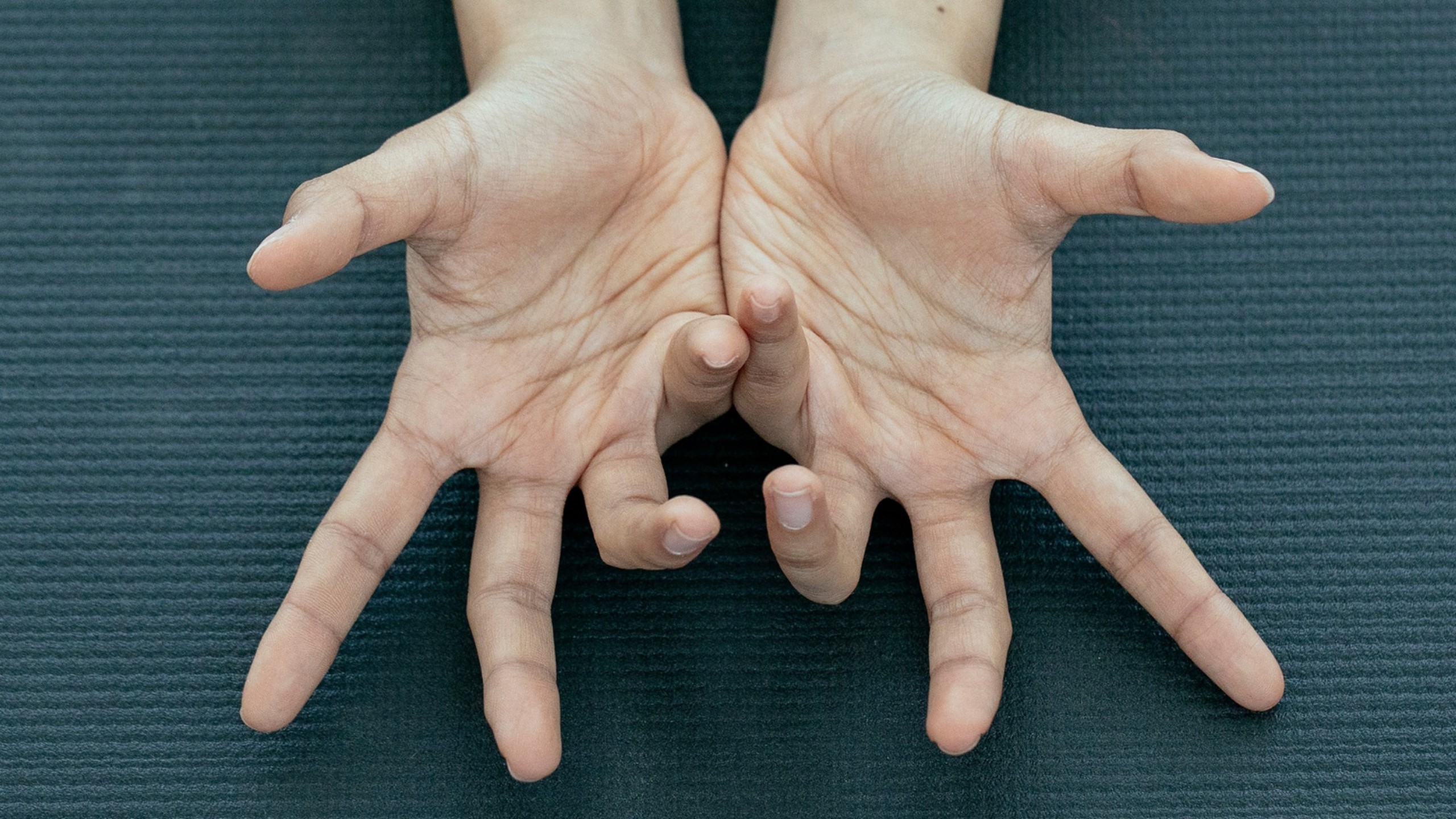 Phác đồ điều trị động kinh và nguyên tắc điều trị bệnh động kinh